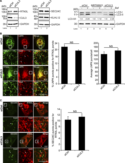 Related toFig. 4. The localization of RTN3L puncta to three-way junctions is not dependent on CUL3KLHL12. (A) Left, the level of RTN3L, but not SEC24C or KLHL12, increases in CUL3-depleted U2OS cells. Western blot analysis was performed with lysates from Ctrl and CUL3-depleted cells. Quantitation of the blot revealed there was approximately a 1.5 times increase of RTN3L in siCUL3-treated cells compared with siCtrl cells, when the RTN3L levels were normalized to GAPDH. Right, western blot analysis was performed with lysates prepared from cells that were treated with DMSO or Baf for 3.5 h. The LC3-II/I ratio is reported in the figure. The data was normalized to GAPDH. (B) Left, cells were transfected with LNPK-GFP and mCherry-RTN3L. Arrowheads mark colocalizing puncta. Middle, quantification of percent LNPK puncta colocalizing with RTN3L puncta, and average LNPK puncta/cell (right) in siCtrl and siCUL3-treated cells. (C) Representative images of the colocalization of mCherry-RTN3L puncta with YFP-SEC24C puncta in Ctrl and CUL3-depleted cells that were treated with Torin 2 for 3.5 h. Arrowheads mark colocalizing puncta. Error bars in B and C represent SEM, n = 3 independent experiments. The results were quantified from 42 to 43 cells in B, and 38–41 cells in C. NS: not significant (P ≥ 0.05), Student’s unpaired t test. Source data are available for this figure: SourceData FS10.
