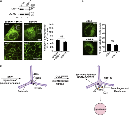 Related toFig. 7. RTN3L–SEC24C, CUL3KLHL12 and PINK1 target ERAD resistant misfolded proteins for ER-phagy at LNPK-marked junctions. (A) Top, siCtrl and siDRP1-treated cells were blotted for the presence of DRP1. GAPDH was used as a loading control. Bottom, siCtrl and siDRP1-treated cells were transfected with Akita-sfGFP. Left, representative images with 10 × 10 µm insets used in the quantitation (right) of ER junctions at the cell periphery (see Materials and methods). (B) Percentage of cell with large Akita puncta/condensates (≥0.5 µm2) were quantified. Error bars in A and B represent SEM, n = 3 independent experiments. The results were quantified from 34 to 38 cells in A, and 73–103 cells in B. NS: not significant (P ≥ 0.05), Student’s unpaired t test. (C) An Akita puncta associates with RTN3L (left) and enlarges in the sheet-like domain of an LNPK-marked junction where the E3 ligase that ubiquitinates RTN3L, CUL3KLHL12, is recruited (right). SEC24C–SEC23 and FIP200 are needed to retain Akita condensates in LC3-containing autophagic structures called ERPHS (right) that are delivered to lysosomes (right) during ER-phagy. The PINK1 kinase, DRP1, and other ER tubulating proteins regulate the formation of peripheral junctions where ERPHS are formed. Key: Ub, ubiquitinated RTN3L. Source data are available for this figure: SourceData FS13. Refer to the image caption for details.