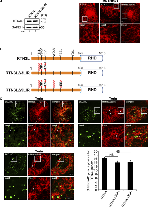 Related toFig. 1. LIRs 1–5 are not needed for the colocalization of SEC24C puncta with RTN3L puncta. (A) Left, a western blot showing that the expression of RTN3L is the same in cells stably expressing mCherry–RTN3L or mCherry–RTN3LΔ6LIR. Right, cells stably expressing mCherry–RTN3L or mCherry–RTN3LΔ6LIR were treated with Torin 2 or MRT68921 for 3.5 h and imaged. (B) Diagram showing the LIR mutations in mCherry-RTN3L. The 6LIRs are shown as black bars and the mutated amino acids are in red. (C) Representative images for the constructs shown in B. The percent SEC24C puncta colocalizing with RTN3L puncta were quantified for the constructs shown in B. Cells were treated for 3.5 h with Torin2. Error bars in C represent SEM, n = 3 independent experiments. The results were quantified from 60 to 66 cells. NS: not significant (P ≥ 0.05), Student’s unpaired t test. Source data are available for this figure: SourceData FS4.