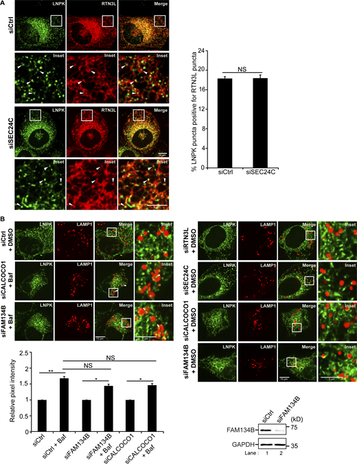 Related toFig. 1. FAM134B and CALCOCO1 are not required for the delivery of LNPK puncta to lysosomes. (A) Left, control and siSEC24C-treated cells transfected with LNPK-GFP and mCherry-RTN3L. Arrowheads mark colocalizing puncta. Right, quantitation of percent LNPK puncta colocalizing with RTN3L puncta. (B) Bottom, same as Fig. 1 F, only siFAM134B and siCALCOCO1-treated cells were examined. The control is the same as in Fig. 1 F as the samples were all assayed at the same time. Bottom right, western blot analysis was performed with control and FAM134B-depleted lysates. GAPDH was used as a loading control. Error bars in A and B represent SEM, n = 3 independent experiments. The results were quantified from 40 to 50 cells in A, and 63–87 cells in B. NS: not significant (P ≥ 0.05), * (P < 0.05), **(P < 0.01), Student’s unpaired t test. Source data are available for this figure: SourceData FS5.