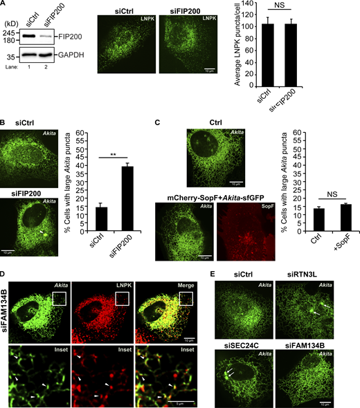 Related toFig. 2. SopF does not inhibit RTN3L–SEC24C-mediated ER-phagy. (A) Left, a western blot showing the depletion of FIP200 in siFIP200-treated cells. GAPDH was used as a loading control. Right, quantitation of LNPK-GFP puncta in siCtrl and siFIP200-treated cells. Representative images are shown on the left. (B) Left, a representative image of a control cell and a siFIP200-treated cell showing the accumulation of a large Akita puncta (see arrowhead). Right, the percent cells with large Akita puncta in control and FIP200-depleted cells. (C) Cells were transfected with Akita-sfGFP or Akita-sfGFP and mCherry-SopF. Representative images are shown on the left and the percent cells with large Akita puncta is graphed on the right. (D) A representative image for the data quantitated in Fig. 2 C. Arrowheads mark Akita-sfGFP puncta that colocalize with LNPK-mCherry puncta. (E) Representative images for the data graphed in Fig. 2 D. Arrows mark large Akita puncta. Error bars in A–C represent SEM, n = 3 independent experiments. The results were quantified from 61 to 64 cells in A, 56–104 cells in B, and 92–95 cells in C. NS: not significant (P ≥ 0.05), **(P < 0.01), Student’s unpaired t test. Source data are available for this figure: SourceData FS6. Refer to the image caption for details.