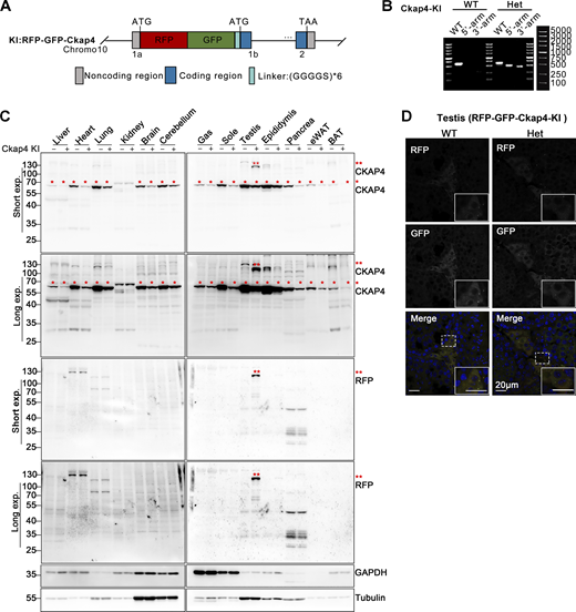 Construction and identification of RFP-GFP-Ckap4 knock-in transgenic mice. (A) Schematic illustrating the construction of the ER-phagy reporter Ckap4-KI using a knock-in mouse model. The tandem fluorescent protein RFP-GFP was inserted at the 5′ end of the first exon of the Ckap4 gene on chromosome 10. (B) Genotyping of transgenic Ckap4-KI mice. Mouse genotypes were identified using PCR with three pairs of primers, as detailed in the materials section. “WT” denotes wild type, “Het” indicates heterozygote. (C) Western blot analysis demonstrating the expression of the Ckap4-KI reporter in knock-in mice. The expression of the Ckap4-KI reporter was assessed in various tissues of both wild-type and knock-in mice. Double red asterisks (**) indicate the fused RFP-GFP-CKAP4 protein, detected by anti-CKAP4 and anti-RFP antibodies. Single red asterisks (*) denote endogenous CKAP4 detected by anti-CKAP4 antibody. GAPDH and Tubulin served as internal controls. Tissues were harvested from 8-wk-old mice. “−” denotes WT, “+” represents heterozygotes. (D) Representative microscopy images illustrating the localization and expression level of the Ckap4-KI reporter in mouse testis tissue. Scale bar: 20 μm. See also Fig. S1. Source data are available for this figure: SourceData F1. Refer to the image caption for details.