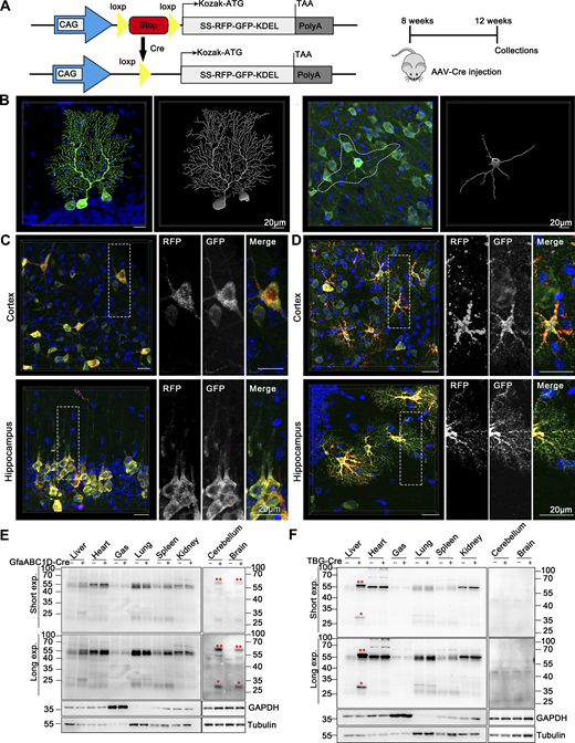 CA-ER-TRG mice enable spatiotemporal measurement of in vivo ER-phagy. (A) Generation of Cre-activated ER-TRG reporter mice (CA-ER-TRG) is illustrated. The gene targeting strategy (left) and the experimental procedure timeline (right) are depicted. CA-ER-TRG mice underwent AAV-Cre infection for 4 wk to induce reporter expression in specific cell types. (B) Confocal microscopy showcases GFP signals in the cerebellar and cerebral neurons of conditional ER-TRG (+/−) mice. Detailed images and 3D reconstructions reveal the ER morphology in Purkinje neurons of the cerebellum (left) and neurons in the brain (right). Infection with AAV-hSyn-Cre for 4 wk facilitated ER-TRG expression in mature neurons (n = 4 per group). Scale bar: 20 μm. (C) ER-phagy levels in mature forebrain neurons of CA-ER-TRG (+/−) mice were assessed. Expression of ER-TRG was induced in these neurons using AAV-hSyn-Cre. RFP-only signals were noted in the soma and axons of selected neurons. Top: Combined signals in the forebrain cortex. Bottom: Combined RFP and GFP signals in the CA1 region of the hippocampus (n = 4 per group). Scale bar: 20 μm. (D) Representative confocal images of RFP and GFP in CA-ER-TRG (+/−) mouse astrocytes. ER-TRG expression in astrocytes was induced using AAV-GFAP-Cre. ER-phagy levels varied among astrocytes in different brain regions. Top: High ER-phagy activity in cortical astrocytes (n = 4 per group). Bottom: Comparatively low activity in hippocampal astrocytes. Scale bar: 20 μm. (E and F) Expression of ssRFP-GFP-KDEL in various tissues of CA-ER-TRG (+/−) transgenic mice. Tissue homogenates from control and CA-ER-TRG (+/−) transgenic mice were analyzed via immunoblotting with specific antibodies. Activation of ssRFP-GFP-KDEL expression in the brain and liver was observed in mice treated with both AAV-GfaABC1D-Cre (E) and AAV-TBG-Cre (F). Full-length RFP-GFP, double red asterisk (**), and RFP fragments, single red asterisks (*), indicative of ER-phagy activity, were detected using an anti-RFP antibody. GAPDH and Tubulin served as internal controls. See also Fig. S5. Source data are available for this figure: SourceData F10. Refer to the image caption for details.