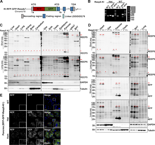 Construction and identification of RFP-GFP-Reep5 knock-in transgenic mice. (A) Schematic for constructing the ER-phagy reporter Reep5-KI using a knock-in mouse model. Tandem fluorescent protein RFP-GFP was inserted at the 5′ end of the first exon of the Reep5 gene on chromosome 18. (B) Genotyping of transgenic Reep5-KI mice. Mouse genotypes were determined using PCR with three pairs of primers, as detailed in the materials section. (C and D) Western blot analysis demonstrating the expression of the Reep5-KI reporter in knock-in mice. The expression of the Reep5-KI reporter was assessed in various tissues of both wild-type and knock-in mice. Double red asterisks (**) indicate the fused RFP-GFP-REEP5 protein, single red asterisks (*) denote endogenous REEP5 identified by anti-REEP5 antibody, and single black asterisks (*) highlight the RFP fragments. GAPDH and Tubulin served as internal controls. Tissues were obtained from 8-wk-old mice. “−” denotes WT, “+” represents heterozygotes, and “++” indicates homozygotes. (E) Representative microscopy images illustrating the localization and expression level of the Reep5-KI reporter in mouse pancreas tissue. Homozygotes are denoted as “Hom.” Scale bar: 20 μm. See also Fig. S1. Source data are available for this figure: SourceData F2.
