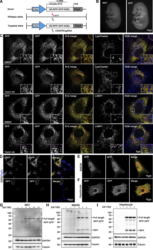 Generation of ER-TRG knock-in mice and assessment of ER-phagy in primary cells derived from the ER-phagy reporter mouse. (A) Schematic representation of the gene targeting strategy illustrating the insertion of ssRFP-GFP-KDEL into the H11 locus to create the ER-TRG mouse model via CRISPR-Cas9 gene editing. The CAG promoter (CMV immediate enhancer/β-actin) and the Kozak sequence (a key eukaryotic mRNA translation initiation site) are highlighted. (B) Whole-mount pictures of E14.5 ER-TRG (+/−) embryos showing the transgenic RFP and GFP fluorescence. Scale bar: 1 mm. (C) Confocal microscopy images showing RFP-GFP fluorescence colocalization with lysosomes in mouse embryonic fibroblast (MEF) cells under mTOR inhibition. MEF cells, isolated from E13.5 ER-TRG (+/−) embryos, were treated with 100 nM Torin1 for 4 h. LysoTracker, a cell-permeable lysosomal marker, was used to identify and trace acidic organelles in live cells. Lysosomes were also marked by LAMP1. Enhanced images demonstrate RFP-only signals colocalizing with lysosomes. The pink arrowheads indicate the ER-phagy sites. Scale bar: 5 μm. (D–F) Confocal microscopy images of RFP and GFP fluorescence in cultured primary cells. Sensory neurons, isolated from dorsal root ganglia (DRG) of E14.5 ER-TRG (+/−) embryos (D), were marked by Tuj1, a neuronal marker. Bone marrow-derived macrophages (BMDMs) (E) and hepatocytes (F) were isolated from adult ER-TRG (+/−) mice. The cells were examined for expression and subcellular localization of the fluorescent proteins. Scale bar: 10 μm. (G–I) Immunoblot analysis showing the expression of ssRFP-GFP-KDEL in primary cells isolated from transgenic mice. Cell extracts from wild-type and ER-TRG transgenic mice were subjected to immunoblotting with specific antibodies. In MEF cells, BMDMs, and hepatocytes, the full-length RFP-GFP was detected in both heterozygotes and homozygotes. Full-length RFP-GFP and RFP fragments were identified using an anti-RFP antibody. The presence of RFP fragments indicates ER-phagy activity, representing the ER-phagy product. GAPDH and Tubulin were used as internal controls. “−” denotes WT, “+” represents heterozygotes, and “++” indicates homozygotes. See also Fig. S2. Source data are available for this figure: SourceData F4.