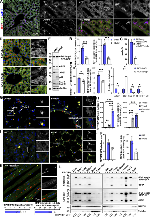 Spatial assessment of ER-phagy activity and ER architecture in different tissues. (A) Co-labeling with LAMP1 indicates that almost all red-positive (RFP+) compartments are also lysosomal marker positive and yield purple (red: RFP+, blue: LAMP1+) signals in the hepatocytes of 8-wk ER-TRG (+/−) mice. Lysosomes not engaged in autophagy (LAMP1 negative) remain blue. Inset: enlarged image of area indicated by dashed frame. Scale bar: 20 μm. (B) Quantitative analysis of different regions of liver from ER-TRG (+/−) reporter mice at adulthood. The calculations were performed for regions inside or outside the yellow dashed box in mouse liver (S3A), referred to as the inner and outer regions. The inner regions represent the vicinity of the CV zone, while the outer regions represent the areas away from the CV zone. The pixel number of RFP-only signals and total RFP signals were calculated by ImageJ and the ratio of RFP: total area (RFP+GFP) was quantified (left). The intensity of RFP-only signals and total RFP signals were calculated by ImageJ on a pixel-by-pixel basis and the fluorescence ratio of RFP: total RFP was quantified (right). Values were stated as mean ± SEM (n = 6). Statistical differences were evaluated using Student’s t test. ***P < 0.001. (C) Quantification of RFP-only ER-lysosomes (RFP+LAMP1+) in liver sections obtained from ER-TRG mice. Values were stated as mean ± SD (n = 4). (D–F) Representative images and quantitative analysis of ER-TRG signals in the liver of control and Atg7-knockdown mice. 8-wk-old ER-TRG (+/−) mice were injected with AAV-shNC and AAV-shAtg7 and underwent a 4-wk infection period. Quantitative analysis of RFP+ signals and immunoblotting of RFP cleavage indicated reduced ER-phagy in hepatocytes after Atg7 knockdown (F). The band intensity of RFP fragments relative to full-length RFP-GFP indicates the presence of ER-phagy products, signifying ER-phagy activity. The efficiency of ATG7 knockdown is evidenced by the expression levels of ATG7, p62, and LC3 in liver samples. GAPDH and Tubulin served as internal controls. Values were stated as mean ± SEM (n = 4 per group). Statistical differences were analyzed using Student’s t test. *P < 0.05, ***P < 0.001. Scale bar: 20 μm. (G–J) Representative confocal images depicting ER-phagy levels in the lung and adipose tissues of ER-TRG (+/−) mice. Quantitative analysis including alveoli and bronchioles (G), brown adipose tissue (BAT), and epididymal white adipose tissue (eWAT) (I) indicated different ER abundance and positioning of ER-phagy signals within tissues (n = 4–6). Magnified images highlight RFP-only signals in cells of various tissues. Adult male ER-TRG (+/−) mice were used in all experiments. Values were stated as mean ± SEM (n = 6) (H). Values were stated as mean ± SD (n = 4–5) (J). Statistical differences were analyzed using one-way ANOVA. **P < 0.01, ***P < 0.001. Scale bar: 20 μm. (K) Representative confocal images depicting ER-phagy levels in the heart sections and quantitative analysis of ER-phagy level of heart in ER-TRG (+/−) mice. Values were stated as mean ± SD (n = 5). Scale bar: 20 μm. (L) Immunoblot analysis of ssRFP-GFP-KDEL expression in various tissues of transgenic mice. Tissue homogenates from one wild-type and one ER-TRG (+/−) transgenic mouse were probed with specific antibodies. Both full-length RFP-GFP and RFP fragments were detected using an anti-RFP antibody. The band intensity of RFP fragments relative to full-length RFP-GFP indicates the presence of ER-phagy products, signifying ER-phagy activity. GAPDH and Tubulin were used as internal controls. See also Fig. S3. Source data are available for this figure: SourceData F5.