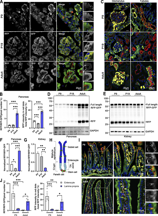 Comparative analysis of ER-phagy and ER network in developing and adult tissues. (A) Representative images of pancreas sections at postnatal day 9 (P9), P19, and in adulthood from ER-TRG (+/−) reporter mice. Scale bar: 20 μm. (B) Quantitative analysis of ER-phagy in pancreas from ER-TRG (+/−) reporter mice at P9, P19, and Adult. Confocal images in 6A were quantified. Values were stated as mean ± SEM (n = 4–5 per group). Statistical differences were evaluated using one-way ANOVA. ***P < 0.001. (C) Representative images of kidney sections at P9, P19, and in adulthood from ER-TRG (+/−) reporter mice (n = 4 per group). Scale bar: 20 μm. (D–G) Immunoblot and quantitative analysis showing ER-phagy activities in pancreas and kidney isolated from ER-TRG (+/−) reporter at P9, P19, Adult. The band intensities of RFP and RFP-GFP were quantified and the ratio of RFP:RFP-GFP (normalized to WT) is shown (F and G). Values were stated as mean ± SEM (n = 4–5 per group). Statistical differences were evaluated using one-way ANOVA. *P < 0.05, **P < 0.01, ***P < 0.001. (H) Schematic representation of the intestinal villus and crypt structure, including cell identities. The mature epithelium comprises goblet cells and enterocytes, while the crypt contains stem cells and Paneth cells in the transit amplifying (TA) zone. (I and J) Representative images of small intestine sections and quantitative analysis of ER-phagy activities in sub-regions at P9 and in adulthood from ER-TRG (+/−) reporter mice. A magnified view highlights RFP-only signals in the cells of the intestinal villus. Values were stated as mean ± SEM (n = 3–5 per group). Statistical differences were evaluated using two-way ANOVA. *P < 0.05, **P < 0.01, ***P < 0.001. Scale bar: 20 μm. Source data are available for this figure: SourceData F6. Refer to the image caption for details.