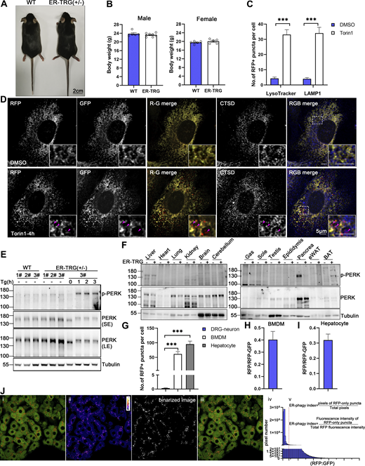 Identification of ER-phagy reporter mouse (related to Fig. 4). (A) Representative images of mouse morphology of wild-type and heterozygous ER-TRG adult mice. Scale bar: 2 cm. (B) Graphs illustrating the body weights of male and female wild-type and heterozygous ER-TRG mice. Statistical analyses of body weights were performed on 8-wk-old male and female mice. Values were stated as mean ± SEM (n = 5–8 per group). Statistical differences were analyzed using Student’s t test. *P <0.05. (C) Quantification of RFP+ puncta colocalization with lysosomes in primary MEF cells under mTOR inhibition. The number of RFP+ puncta that colocalized with LysoTracker or LAMP1 signals was calculated using ImageJ for each treatment. Data were collected from 20 to 30 cells for each condition. Values were stated as mean ± SEM. Statistical differences were analyzed using two-way ANOVA. ***P < 0.001. (D) Confocal microscopy images showing the colocalization of RFP-GFP fluorescence with lysosomes in primary MEF cells under mTOR inhibition. MEF cells, derived from E13.5 ER-TRG (+/−) embryos, were treated with 100 nM Torin1 for 4 h. CTSD, a lysosomal enzyme, was employed as a lysosomal marker. Enlarged views reveal RFP-only signals colocalizing with lysosomes. The pink arrowheads indicate the ER-phagy sites. Scale bar: 5 μm. (E) Immunoblot analysis of PERK and p-PERK in primary MEF cell extracts. Cells were isolated from E13.5 embryos of ER-TRG (+/−) pregnant mice. Samples labeled #1, #2, and #3 represent cells from different mice. Cells #3 from the ER-TRG (+/−) group were used as a positive control, treated with Tg (1 μM) for 0, 1, 2, 3 h, respectively. “SE” denotes short exposure, while “LE” indicates long exposure. (F) Immunoblot analysis of PERK and phosphorylated PERK (p-PERK) in various tissues of wild-type and heterozygous ER-TRG mice. Tissue homogenates were probed using specific anti-PERK and p-PERK antibodies. Tubulin served as an internal control. (G) Quantitative analysis of ER-phagy levels in primary cells from ER-TRG (+/−) mice. The number of RFP+ puncta per cell in sensory neurons, BMDMs and hepatocytes was calculated using ImageJ and quantified for each treatment. Values were stated as mean ± SEM. Statistical differences were analyzed using one-way ANOVA. ***P < 0.001. (H and I) Quantitative analysis of immunoblotting showing ER-phagy activities in BMDMs and hepatocytes isolated from ER-TRG (+/−) mice. The band intensity of RFP fragments relative to full-length RFP-GFP indicates the presence of ER-phagy products, signifying ER-phagy activity. Values were stated as mean ± SD (n = 3). (J) Fluorescence quantification methods. The level of ER-phagy was defined from two aspects: (a) ER-phagy is defined as the number of pixels of RFP-only puncta divided by the total pixels (RFP + GFP), which is used to delineate the total area of tissue or cells because some section images did not completely fill the field of view. (b) ER-phagy is also defined as the fluorescence intensity ratio of lysosomal signals (RFP-only puncta) to total RFP signals. The method is described in detail in Materials and methods. Source data are available for this figure: SourceData FS2.