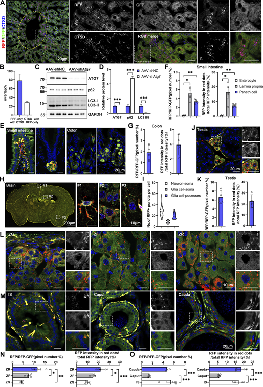 Spatial assessment of ER-phagy activity and ER architecture in different tissues (related to Fig. 5). (A) Colabeling with CTSD indicates that almost all red-positive compartments are also lysosomal marker positive and yield purple (red: RFP+, blue: CTSD+) signals in the hepatocytes of 8-wk-old ER-TRG (+/−) mice. Lysosomes not engaged in autophagy (CTSD negative) remain blue. An inset shows an enlarged view of the area indicated by the yellow dashed frame. The area inside the yellow dashed box represents the vicinity of the CV zone, while the area outside the yellow dashed box represents the areas away from the CV zone. Scale bar: 20 μm. (B) Quantification of RFP-only ERlysosomes (RFP+CTSD+) in liver sections obtained from ER-TRG mice. Values were stated as mean ± SD (n = 4). (C and D) Immunoblotting analysis of ATG7, p62, and LC3 in primary hepatocytes indicates the efficiency of ATG7 knockdown by AAV infection. Cell extracts from AAV-shNC and AAV-shAtg7 transgenic mice were examined via immunoblotting with specific antibodies. GAPDH and Tubulin served as internal controls. Values were stated as mean ± SEM (n = 5 per group). Statistical significance was determined using Student’s t test, with ***P < 0.001. (E–G) Confocal imaging and quantitative analysis of the intestines and colons from adult ER-TRG (+/−) reporter mice reveal varied ER abundance and ER-phagy activity in the villi of the small intestine and crypt (left) (E and F), compared to the comparable ER-phagy activity in colon cells (right) (E and G). Values were stated as mean ± SEM (n = 4) (F). Values were stated as mean ± SD (n = 4) (G). Statistical differences were analyzed using one-way ANOVA. *P < 0.05, **P < 0.01. Scale bar: 20 μm. (H and I) ER abundance and positioning of ER-phagy signals within the mouse brain. Magnified images highlight RFP-only signals in cells of various tissues, with specific focus on an astrocyte (#1), neurons around the hippocampus (#2), and neurons around the cortex (#3) in the brain. Quantitative analysis of ER-phagy puncta of cells in the brain of adult male ER-TRG (+/−) mice (I). n = 60–80 cells per group from three mice. Scale bars: 200 μm (thumbnail), 10 μm (inset). (J and K) Confocal imaging and quantitative analysis of ER-phagy level of the testis in adult male ER-TRG (+/−) reporter mice. Values were stated as mean ± SD (n = 4). Scale bar: 20 μm. (L–O) Confocal imaging of the adrenal glands and epididymis from adult ER-TRG (+/−) mice. Magnified images depicting the smooth ER (SER) architecture and localization of ER-phagy signals within the adrenal glands (L and N). The zona grannulosa (ZG), zona fasciculata (ZF), and zona reticulosa (ZR) regions were examined. A magnified view highlights RFP-only signals in cells of adrenal glands (n = 4). Scale bar: 10 μm. Magnified images and quantitative analysis show RFP-only signals in cells of epididymis, with the initial segment (IS), caput, and cauda regions displaying varying levels of ER-phagy across different cell types (n = 4) (M and O). Values were stated as mean ± SEM. Statistical differences were analyzed using one-way ANOVA. *P < 0.05, **P < 0.01, ***P < 0.001. Scale bar: 20 μm. Source data are available for this figure: SourceData FS3.