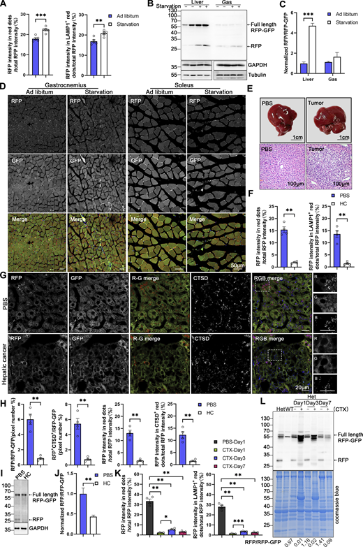 Assessment of ER-phagy in physio-pathological perturbations (related to Fig. 8). (A) Quantitative analysis indicated increased RFP+ and RFP+LAMP1+ signals at liver during starvation. The fluorescence intensity of RFP-only, RFP+LAMP1+ and total area were calculated respectively by ImageJ and the fluorescence ratio of RFP-only (or RFP+LAMP1+): the total RFP was quantified. Values were stated as mean ± SEM (n = 5 per condition). Statistical differences were analyzed using Student’s t test. **P < 0.01, ***P < 0.001. (B and C) Analysis of ER-phagy levels in the liver and skeletal muscle of transgenic mice during starvation by immunoblotting. Tissue homogenates from both regularly fed and starved mice were examined through immunoblotting. Full-length RFP-GFP and RFP fragments were detected with an anti-RFP antibody and the band intensity of RFP fragments relative to full-length RFP-GFP indicates the presence of ER-phagy products, signifying ER-phagy activity. GAPDH and Tubulin served as internal controls. Adult male wild-type and ER-TRG (+/−) mice were used in experiments. Values were stated as mean ± SEM (n = 4 per condition). Statistical differences were analyzed using two-way ANOVA. ***P < 0.001. (D) Confocal imaging of RFP and GFP signals in the skeletal muscles (gastrocnemius, soleus) of ER-TRG (+/−) mice under normal feeding and starvation. Scale bar: 50 μm. (E) Hematoxylin and Eosin (HE) staining of liver sections from PBS-treated and hepatic cancer model mice in ER-TRG (+/−) mice. Control mice received PBS injections, while model mice were injected with plasmids expressing C-Myc, N-Ras, and SB11 for 4 wk. Scale bars: 1 cm (top), 100 μm (bottom). (F) Quantitative analysis indicated reduced RFP+ and RFP+LAMP1+ signals at tumor sites compared with control liver or adjacent tissue. The fluorescence ratio of RFP-only (or RFP+LAMP1+): the total RFP was quantified. Values were stated as mean ± SEM (n = 4 per condition). Statistical differences were analyzed using Student’s t test. **P < 0.01. (G and H) ER-phagy levels and quantitative analysis in the liver of ER-TRG (+/−) mice with hepatic cancer. Confocal imaging reveals diminished ER-phagy at tumor sites relative to control liver or adjacent tissues, as indicated by CTSD co-staining. The pixel number, fluorescence intensity of RFP-only, RFP+CTSD+ and total area were calculated by ImageJ. The ratio of RFP-only (or RFP+CTSD+): the total area (RFP+GFP) and the fluorescence ratio of RFP-only (or RFP+CTSD+): the total RFP were quantified. Values were stated as mean ± SEM (n = 4 per condition). Statistical differences were assessed using Student’s t test. **P < 0.01. Scale bar: 20 μm. (I and J) Analysis of ER-phagy levels in the liver of ER-TRG (+/−) mice with hepatic cancer by immunoblotting. Values were stated as mean ± SEM (n = 4 per condition). Statistical differences were analyzed using Student’s t test. **P < 0.01. (K) Quantitative analysis indicated altered RFP+ and RFP+CTSD+ signals in muscle cells at injury area compared to PBS-treated tissue. The fluorescence ratio of RFP-only (or RFP+LAMP1+): the total RFP was quantified. Values were stated as mean ± SEM (n = 4 per condition). Statistical differences were analyzed using one-way ANOVA and Kruskal–Wallis test. *P < 0.05, **P < 0.01, ***P < 0.001. (L) Analysis of ER-phagy levels in the skeletal muscle of ER-TRG (+/−) mice with CTX injury by immunoblotting. The band intensity of RFP fragments relative to full-length RFP-GFP indicates the presence of ER-phagy products, signifying ER-phagy activity. Coomassie blue staining confirmed protein loading. Adult male wild-type and ER-TRG (+/−) mice were used in experiments. Source data are available for this figure: SourceData FS4.
