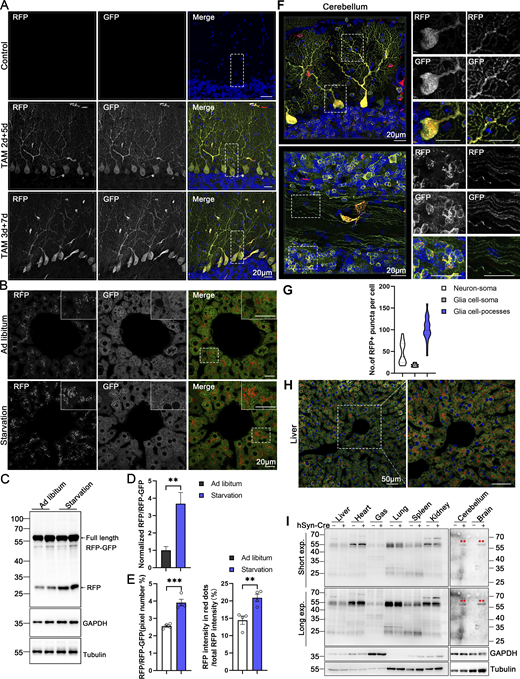 Assessment of ER-phagy activity in different tissues in inducible ER-TRG mice and in different CA-ER-TRG mice (related to Figs. 9 and 10). (A) Representative image of ER-phagy levels in cerebellum of inducible ER-TRG (Rosa CreERT2+/−; LSL-RFP-GFP-KDEL+/−) mice. The Rosa CreERT2−/−; LSL-RFP-GFP-KDEL+/−was used as control. (B–D) Analysis of ER-phagy levels in the liver of inducible ER-TRG (Rosa CreERT2+/−; LSL-RFP-GFP-KDEL+/−) mice by immunoblotting under ad libitum feeding and starvation conditions, respectively. Mice underwent a 16-h fast with free access to water, while control mice had ad libitum access to both food and water. Mice were treated with tamoxifen for 2 or 3 days, and samples were analyzed after 5 or 7 days. The immunoblots were quantified in panel D. Values were stated as mean ± SEM (n = 4 per group). Statistical differences were evaluated using Student’s t test. **P < 0.01. Scale bar: 20 μm. (E) Representative confocal images and quantitative analysis in the liver of inducible ER-TRG (Rosa CreERT2+/−; LSL-RFP-GFP-KDEL+/−) mice under starvation. Quantitative analysis revealed the ratio of RFP: total area (RFP+GFP) and the fluorescence ratio of RFP: total RFP intensity by ImageJ on a pixel-by-pixel basis. Values were stated as mean ± SEM (n = 4 per condition). Statistical differences were evaluated using Student’s t test. **P < 0.01, ***P < 0.001. Scale bar: 20 μm. (F) Assessment of ER-phagy in mature cerebellar neurons of CA-ER-TRG (+/−) mice. ER-TRG expression was induced in mature neurons using AAV-hSyn-Cre (n = 4 per group). RFP signals were detected in the soma and neuronal processes. Top: Combined RFP and GFP signals in the molecular layer. Bottom: Combined signals in the granule cell layer. Scale bar: 20 μm. (G) Quantitative analysis of ER-phagy levels in neurons and glia cells from AAV-hSyn-Cre-activated ER-TRG mice. The number of RFP-only puncta per soma or pocesses in hippocampal neurons and glia cells in brain was calculated using ImageJ and quantified for each treatment. n = 50–80 cells per group from three mice. (H) Confocal microscopy images of RFP and GFP fluorescence in the liver of AAV-TBG-Cre-activated ER-TRG (+/−) mice (n = 4 per group). The overlay of RFP and GFP signals corresponds with liver section images in ER-TRG mice. Scale bar: 50 μm. (I) Immunoblot analysis of ssRFP-GFP-KDEL in the brains of CA-ER-TRG mice revealed specific expression and ER-phagy signals in neurons induced by AAV-hSyn-Cre. Tissue homogenates from a control mouse and a CA-ER-TRG (+/−) transgenic mouse were examined using specific antibodies. Full-length RFP-GFP, double red asterisk (**) markers, were detected with an anti-RFP antibody. GAPDH and Tubulin were used as internal controls. Source data are available for this figure: SourceData FS5. Refer to the image caption for details.