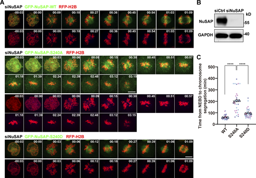 Phospho-null NuSAP resulted in delayed mitosis progression. (A) RFP-H2B (red) expressing HeLa cells with NuSAP siRNA knockdown were processed for rescue experiments with GFP-tagged NuSAP-WT, -S240A, and -S240D (green) followed by live-cell imaging. Images were captured every 3 min with five slices of 8-μm Z-section thickness. (B) Detection of NuSAP RNAi knockdown efficiency in HeLa cells by Western blotting. (C) Quantification of the time from NEBD to chromosome segregation, shown in A. Error bars indicate SD. Three independent replicates of 10 cells per replicate were quantified (n = 3). Unpaired two-tailed t test. P < 0.0001 for WT/S240A. P < 0.0001 for S240A/S240D. ****, P < 0.0001. n = the number of independent experiments presented. Scale bars, 10 μm. Source data are available for this figure: SourceData FS2. Refer to the image caption for details.