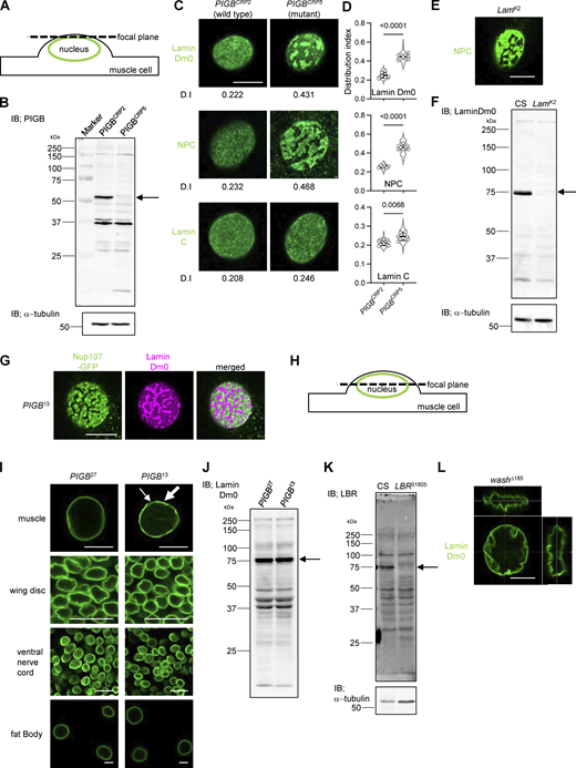 Related toFig. 2. (A) Schematic image of a muscle nucleus with the focal plane. Green indicates the nuclear membrane, and the dotted line indicates the focal plane. (B) Immunoblot analysis of PIGB in larval carcasses of PIGBCRP2 and PIGBCRP5. The arrow indicates PIGB. α-Tubulin was used as a loading control. (C) Distributions of Lamin Dm0, NPCs, and Lamin C in a nucleus of larval wall skeletal muscle in PIGBCRP2 (control) and PIGBCRP5 (mutant). The number at the bottom of the image is the D.I. Bar, 10 μm. (D) Quantification of the distributions of Lamin Dm0, NPCs, and Lamin C in a nucleus of larval wall skeletal muscle in the PIGBCRP2 and PIGBCRP5 larvae shown in C. 10–12 nuclei per individual were measured and the average value was plotted for six individuals (white circle). The thick black horizontal bar and thin gray horizontal bar show the mean and SD of six biological replicates, respectively; >60 nuclei analyzed per strain. The superimposed violin plot shows the distribution of the D.I. The number at the top of the graph is the P value (biological replicates = 6) calculated using the unpaired two-tailed t test. (E) Distribution of NPCs (green) in the Lamin Dm0 mutant (LamK2). Bar, 10 μm. (F) Immunoblot analysis of Lamin Dm0 in larval carcasses of CS (WT) and LamK2. The arrow indicates Lamin Dm0. α-Tubulin was used as a loading control. (G) Complementary distributions of Nup107-GFP (green) and Lamin Dm0 (magenta) in PIGB13. Bar, 10 μm. (H) Schematic image of a muscle nucleus with the focal plane for observation in I. Green indicates the nuclear membrane, and the dotted line indicates the focal plane. (I) Distributions of Lamin Dm0 (green) in nuclei of muscle, a wing disc, a ventral nerve cord, and a fat body. In the nuclear membrane of PIGB13 muscle cells, both dense regions (indicated by thick arrows) and sparse regions (indicated by thin arrows) of Lamin Dm0 are observed, while the distribution of Lamin Dm0 remains unchanged compared with the WT in other tissues. Bar, 10 μm. (J) Long-exposed and uncropped immunoblot image of Lamin Dm0 is shown in Fig. 2 D. The arrow indicates Lamin Dm0. (K) Immunoblot analysis of LBR in larval carcasses of the WT (CS) and LBR−/− (LBR31805). The arrow indicates LBR. α-Tubulin was used as a loading control. (L) 3D observation of Lamin Dm0 in the washΔ185 mutant. The surface of the nucleus is wrinkled, but Lamin Dm0 is distributed uniformly. Bar, 10 μm. Source data are available for this figure: SourceData FS1.