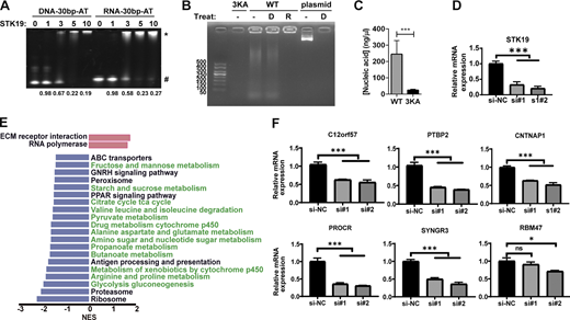 STK19 also binds dsRNA and influences mRNA expression levels. (A) Comparative analysis of STK19 binding to 30-bp dsDNA and 30-bp dsRNA by EMSA. The numbers at the bottom represent the ratio of unbound DNA (unbound/total). (B) Gel electrophoresis of STK19-bound nucleic acids treated with DNase (D) or RNase (R). A 6 k bps dsDNA plasmid was used as a control to illustrate the activity of DNase. (C) The level of nucleic acid bound by GST-STK19 or the 3KA mutant. Error bars represent the SD of three biological repeats, two-tailed unpaired Student’s t test was used. (D) qPCR analysis of STK19 mRNA expression levels in STK19 siRNA KD HeLa cells. Error bars represent the SEM of three biological repeats. All groups were compared with si-NC, and two-tailed unpaired Student’s t test was used. (E) Selected pathways from GSEA based on the KEGG database that represented the most significant changes between NC (si-NC) and STK19 KD (si#1) in HeLa cells. Compared with NC, the upregulated and downregulated pathways in STK19 KD cells are represented by red (right) and blue (left) bars. Downregulated metabolic pathways are colored green. (F) qPCR analysis of mRNA levels for six downregulated proteins in TMT proteomic analysis. Error bars represent the SEM of three biological repeats. Two-tailed unpaired Student’s t test was used. * denotes P < 0.05; *** denotes P < 0.001. Source data are available for this figure: SourceData F7.