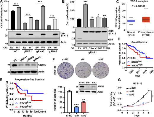 STK19 is critical for the proliferation of HeLa and HCT116 cells. (A) Cell viability of NC and STK19 KD HeLa cells. NC (control gRNA/CRISPR/Cas9 mediated NC) and KD (gRNA/CRISPR/Cas9 mediated STK19 KD). After seeding in 96-well plates, cells were transfected with EV (empty vector) or gRNA-resistant HA-STK19 and cultured for 3 days prior to sulforhodamine B staining. Error bars represent SEM. Two-tailed unpaired Student’s t test was used. ***P < 0.001. STK19 KD efficiency before seeding was analyzed by western blotting and shown in the bottom panel. (B) Cell viability of STK19 KD cells (gRNA1) transfected with gRNA-resistant WT, 3KA, or dimerization mutants. Error bars represent SEM. All groups were compared with EV, and two-tailed unpaired Student’s t test was used. OE: overexpression. (C) Boxplot showing relative mRNA expression of STK19 between normal and colorectal cancer samples in TCGA samples using UALCAN web portal (https://ualcan.path.uab.edu). (D) Kaplan–Meier plot depicting overall survival of CRC patients with tumors expressing high (red) or low (blue) levels of STK19 in TCGA samples using the online database OncoLnc (Gehan-Breslow-Wilcoxon test). (E) Kaplan–Meier plot depicting overall survival of CRC patients with tumors expressing high (red) or low (blue) levels of STK19 using the online database GEPIA2 (log-rank test). (F) Western blot analysis of STK19 protein levels in HCT116 cells transduced with two different siRNAs targeting STK19 coding region (si#1 and si#2) or nontargeting control (si-NC). Representative images and quantification of colony formation assay for HCT116 cells with STK19 KD. Error bars represent the SEM of three biological replicates. Two-tailed unpaired Student’s t test was used. **P < 0.01; ***P < 0.001. (G) Cell growth of HCT116 cells with STK19 KD detected by CCK8 assay compared with their control (si-NC). Error bars represent the SEM of three biological replicates. Two-tailed unpaired Student’s t test was used. ***, P < 0.001. The molecular weights are in kD. Source data are available for this figure: SourceData F8.