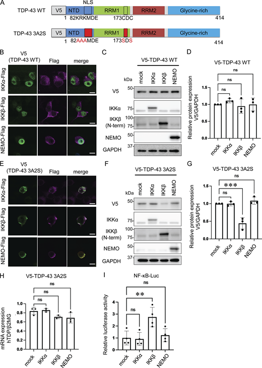 Reduction of aggregation-prone TDP-43 by IKKβ. (A) Schematic illustrations of TDP-43 WT and the aggregation-prone TDP-43 mutation, TDP-43 3A2S, in which NLS and RRM1 are modified, respectively. (B) Immunofluorescence images of Neuro2a cells expressing V5-TDP-43 WT and each Flag-IKK: IKKα, IKKβ, or NEMO (green, V5; violet, Flag). Scale bars = 10 μm. (C) Representative immunoblots of Neuro2a cell lysates expressing V5-TDP-43 WT and each Flag-IKK. (D and G) Densitometric quantifications of V5 normalized with GAPDH (n = 3 for each group). (E) Immunofluorescence images of Neuro2a cells expressing V5-TDP-43 3A2S and each Flag-IKK (green, V5; violet, Flag). Scale bars = 10 μm. (F) Representative immunoblots of whole Neuro2a cell lysates expressing V5-TDP-43 3A2S and each Flag-IKK. (H) mRNA expression levels of human TDP-43 as measured via qRT-PCR. Data are shown as TDP-43 level-to-β2MG level ratios in human mRNA (n = 3 for each group). (I) Relative NF-κB activity of Neuro2a cells expressing each Flag-IKK (n = 3 for each group). In D and G–I, data were analyzed via analysis of variance (ANOVA) and Tukey’s test. Error bars indicate SDs. *P < 0.05, **P < 0.01, ***P < 0.001. ANOVA, analysis of variance; β2MG, beta-2-microglobulin; CTD, C-terminal domain; GAPDH, glyceraldehyde 3-phosphate dehydrogenase; IKK, inhibitory kappa-β kinase. Source data are available for this figure: SourceData F1. Refer to the image caption for details.