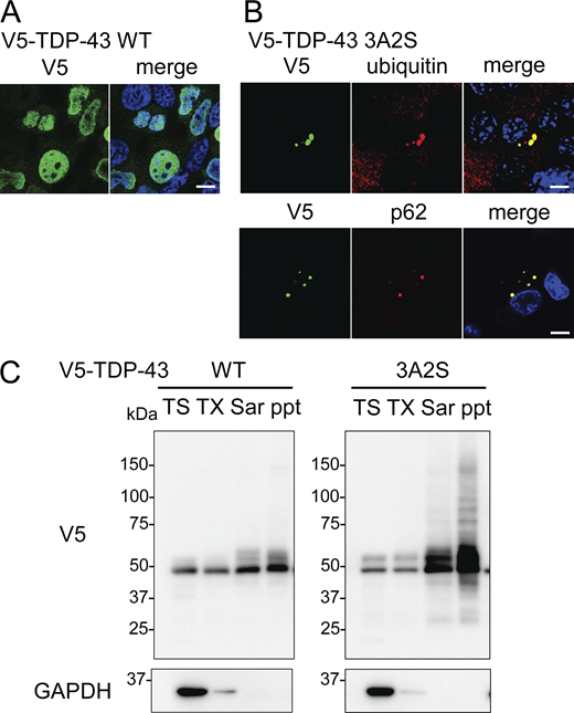Distributions and solubilities of TDP-43 WT and 3A2S mutant. (A and B) Immunofluorescent images of Neuro2a cells expressing V5-TDP-43 WT (A) or 3A2S (B) (green; V5, red; ubiquitin or p62, blue; DAPI). Scale bars = 10 μm. (C) Sequential extraction analysis of Neuro2a cells expressing V5-TDP-43 WT or 3A2S using Tris (TS), Triton X-100 (TX), Sarkosyl (Sar), and SDS buffers. Source data are available for this figure: SourceDataFS1. Refer to the image caption for details.