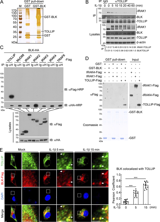 BLK associates with TOLLIP. (A) Identification of the BLK interactome by silver staining and mass spectrometry methods. Silver staining showed GST-associated factors (Control) and GST-BLK–associated factors, respectively. TOLLIP was among the convincing interacting factors. (B) Endogenous interaction between TOLLIP and IRAK1 or BLK. U87MG cells (2 × 107) were left untreated or treated with IL-1β (20 ng/ml) for the indicated times. Coimmunoprecipitation (IP) and immunoblot (IB) analysis were performed with the indicated antibodies. (C) BLK interacts with TOLLIP in the mammalian overexpression system. HEK293 cells (2 × 106) were transfected with the indicated plasmids for 24 h. Coimmunoprecipitation and immunoblot analysis were performed with the indicated antibodies. (D) BLK directly binds to TOLLIP. Prokaryotically expressed and purified GST-BLK protein coupled to glutathione sepharose beads was incubated with purified Flag-tagged IRAK1, IRAK4, or TOLLIP proteins for 3 h at 4°C and then subjected to in vitro GST pull-down assays. (E) BLK colocalizes with TOLLIP upon IL-1β stimulation (left panel). U87MG cells stably expressing BLK (1 × 105) were left untreated or treated with IL-1β (20 ng/ml) for the indicated times, then fixed with 4% PFA and stained with anti-Flag and anti-TOLLIP antibodies before confocal microscopy. The arrow marks the colocalized pixels. Scale bars, 2 μm. Quantitative analysis of colocalization of BLK with TOLLIP (right panel). Statistical analysis was based on colocalization images using ImageJ software. Graphs show mean ± SD (n = 12 cells from three individual images). ***P < 0.001 (unpaired, two-tailed Student’s t test). Data are representative of at least two independent experiments with similar results. Source data are available for this figure: SourceData F3.