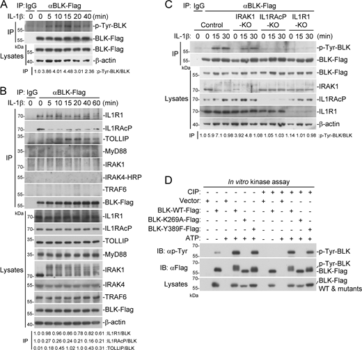 Preassociation of BLK with IL1R1 and IL1RAcP is necessary for BLK autophosphorylation. (A) BLK undergoes tyrosine phosphorylation following IL-1β stimulation. U87MG cells stably expressing BLK (2 × 107) were left untreated or treated with IL-1β (20 ng/ml) for the indicated times. Coimmunoprecipitation (IP) and immunoblot (IB) analysis were performed with the indicated antibodies. (B) BLK is constitutively associated with IL1R1 and IL1RAcP under unstimulated conditions. U87MG cells stably expressing BLK (2 × 107) were left untreated or treated with IL-1β (20 ng/ml) for the indicated times. Coimmunoprecipitation and immunoblot analysis were performed with the indicated antibodies. (C) IL1R1 or IL1RAcP deficiency abolishes IL-1β–induced BLK phosphorylation. U87MG cells were transduced with control or gRNA plasmids targeting IRAK1, IL1R1, or IL1RAcP genes by the CRISPR/Cas9 method to establish stable cell lines. The indicated cell lines (2 × 105) were left untreated or treated with IL-1β (20 ng/ml) for the indicated times before immunoblot analysis. KO, knockout. (D) BLK catalyzes autophosphorylation in a kinase activity-dependent manner. Purified Flag-tagged BLK and its mutants coupled with Protein G sepharose were subjected to in vitro BLK autophosphorylation assays without or with CIP treatment. The detailed procedures are shown in Materials and methods. Data are representative of three independent experiments with similar results. Source data are available for this figure: SourceData F5. Refer to the image caption for details.