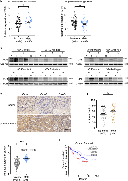 XAF1 is upregulated in mCRC and high expression of XAF1 indicates poor prognosis. (A) XAF1 mRNA expression in primary CRC tissues from KRAS-mutant and KRAS wide-type patients with metastatic or non-metastatic CRC in TCGA COAD dataset. (B) XAF1 expression in 20 pairs of normal (N) and the matched CRC tumor (T) tissues was examined by Western blot. (C) Representative immunohistochemical staining of XAF1 in paired normal and primary tumor tissues from CRC patients. Scale bar, 200 μm. (D) H-scores of XAF1 protein in primary CRC tissues from CRC patients with or without metastasis. (E) mRNA expression of XAF1 in primary and metastatic CRC tissues in the GEO dataset (accession no. GSE131418). (F) Overall survival of 378 CRC patients with low or high XAF1 expression was analyzed by Kaplan–Meier analysis using the GEPIA web tool. The data in A, D, and E were analyzed by two-tailed unpaired Student’s t test and represented as the mean ± SEM. *P < 0.05, **P < 0.01, ***P < 0.001. Source data are available for this figure: SourceData F1. Refer to the image caption for details.