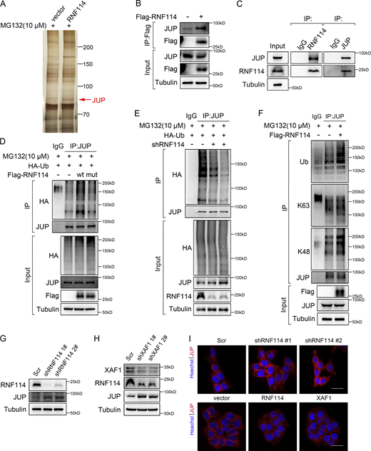 Identification of JUP as a substrate of RNF114. (A) Silver-stained gel showing differential bands between control and RNF114-overexpressing samples. Cells were treated with 10 μM MG132 for 8 h. (B and C) The interaction between RNF114 and JUP was examined by co-IP assay. IgG was used as a negative control. (D) The ubiquitination of JUP was examined in 293T cells transfected with vector, wild-type, and mutant RNF114, respectively. Cells were treated with 10 μM MG132 for 8 h. IgG was used as a negative control. (E) The ubiquitination of JUP was examined in control and RNF114-depleted HCT116 cells. Cells were treated with 10 μM MG132 for 8 h. IgG was used as a negative control. (F) Co-IP was performed to detect the types of ubiquitin chains on JUP. Cells were treated with 10 μM MG132 for 8 h. IgG was used as a negative control. (G) Western blot showing JUP protein level in control and RNF114 knockdown HCT116 cells. Scr, Scramble. (H) Protein levels of RNF114 and JUP in control and XAF1 knockdown HCT116 cells. Scr, Scramble. (I) Immunofluorescence staining showing JUP expression in control and RNF114 knockdown HCT116 cells (upper), and control, RNF114/XAF1-overexpressing HCT116 cells (lower). Scr, Scramble, Scale bar, 45 μm. Source data are available for this figure: SourceData F5. Refer to the image caption for details.