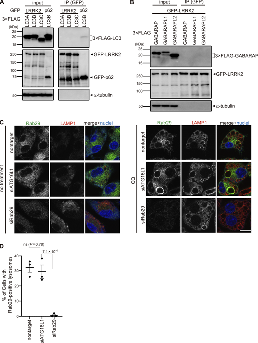 Analyses on the possibility of LRRK2 recruitment via ATG8 or Rab29. (A and B) Lack of binding between LRRK2 and ATG8 family proteins. Immunoprecipitation (IP) analysis of HEK293 cells overexpressing 3×FLAG-taggted LC3A/B/C (A) or GABARAP/GABARAPL1/GABARAPL2 (B) together with GFP-tagged LRRK2 or p62. Pulldown using GFP-trap resulted in the precipitation of LC3 with p62 but not with LRRK2. (C) Fluorescence images of endogenous Rab29 in RAW264.7 cells transfected with siATG16L1 or siRab29 (positive control) and treated with (right) or without (left) CQ. Scale bar, 10 μm. (D) Percentage of cells harboring Rab29-positive lysosomes, as shown in C. Data represent mean ± SEM (N = 3 independent experiments). The difference was analyzed using one-way ANOVA with Dunnet’s test. Source data are available for this figure: SourceData FS4.