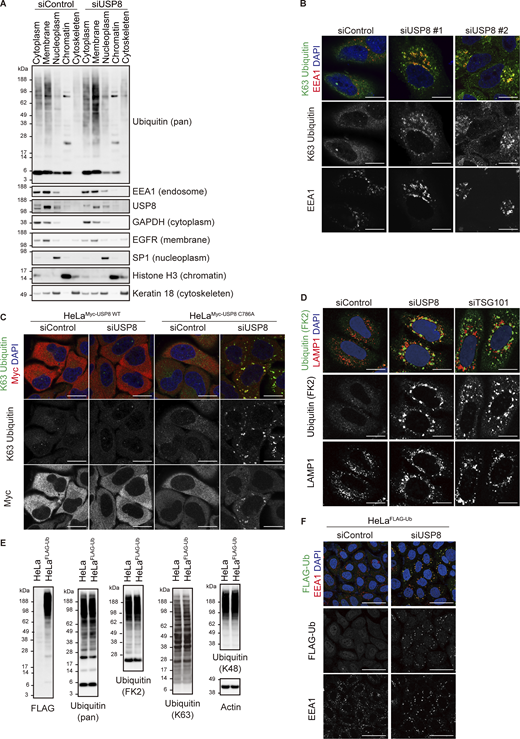 Ubiquitin accumulation in USP8-depleted cells. (A) HeLa cells transfected with the indicated siRNAs were subjected to subcellular fractionation. Each fraction (cytoplasm, membrane, nucleoplasm, chromatin, and cytoskeleton) was immunoblotted with the indicated antibodies. (B) HeLa cells transfected with the indicated siRNAs were immunostained with the indicated antibodies and DAPI. Scale bar, 20 μm. (C) HeLa cells stably expressing siRNA-resistant Myc-USP8 WT and C786A were transfected with the indicated siRNAs. Cells were immunostained with the indicated antibodies and DAPI. Scale bar, 20 μm. (D) HeLa cells transfected with the indicated siRNAs were immunostained with the indicated antibodies and DAPI. Scale bar, 20 μm. (E) Total cell lysates from parental HeLa cells and HeLa cells stably expressing FLAG-Ub were immunoblotted with the indicated antibodies. (F) HeLa cells stably expressing FLAG-Ub were transfected with the indicated siRNAs. Cells were immunostained with the indicated antibodies and DAPI. Scale bar, 50 μm. Source data are available for this figure: SourceData FS1.