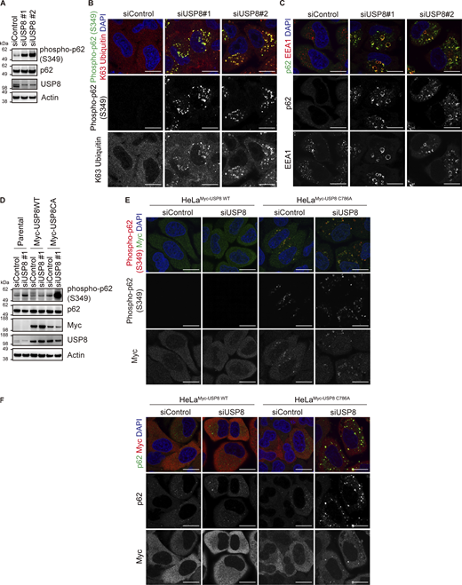Accumulation of phosphorylated p62 on endosomes in USP8-depleted cells. (A) Total cell lysates from HeLa cells transfected with the indicated siRNAs were immunoblotted with the indicated antibodies. (B and C) HeLa cells transfected with the indicated siRNAs were immunostained with the indicated antibodies and DAPI. Scale bar, 20 μm. (D) Parental HeLa cells and HeLa cells stably expressing siRNA-resistant Myc-USP8 WT and C786A were transfected with the indicated siRNAs. Total cell lysates from cells were immunoblotted with the indicated antibodies. (E and F) HeLa cells stably expressing siRNA-resistant Myc-USP8 WT and C786A were transfected with the indicated siRNAs. Cells were immunostained with the indicated antibodies and DAPI. Scale bar, 20 μm. Source data are available for this figure: SourceData FS4. Refer to the image caption for details.