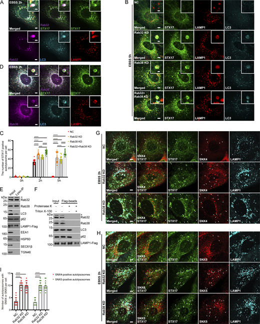 Rab32 and Rab38 are required for ACR. (A) U2OS cells stably expressing Flag-STX17 with mKO-Rab32 were starved with EBSS for 2 h, and stained with antibodies against Flag, LC3, and LAMP1. Scale bar, 5 μm. Inset scale bar, 1 μm. (B) U2OS cells stably expressing Flag-STX17 were transfected with non-targeting siRNA (NC), siRNAs against Rab32, Rab38, or Rab32 and Rab38. 48 h after transfection, cells were starved with EBSS for 5 h and stained with antibodies against Flag, LC3, and LAMP1. Scale bar, 5 μm. Inset scale bar, 1 μm. (C) Quantification of STX17-positive autolysosome number. Images in B and (S2C) were analyzed. Data are means ± SD (n = 3, 60 cells from three independent experiments were quantified). ****P < 0.0001, ***P < 0.001. Two-way ANOVA. (D) U2OS cells stably expressing Flag-STX17 with mKO-Rab38 were starved with EBSS for 2 h, and stained with antibodies against Flag, LC3, and LAMP1. Scale bar, 5 μm. Inset scale bar, 1 μm. (E) HEK293T cells were treated with EBSS for 2 h. Then Lyso-IP was performed. The resultant samples were subjected to immunoblot analysis with the indicated antibodies. * indicates a non-specific band. (F) The samples from Lyso-IP were split into three aliquots and subjected to different conditions: No treatment, 0.1 μg/ml proteinase K (PK), or 0.1 μg/ml proteinase K in the presence of 0.2% Triton X-100. Then immunoblot analysis was performed with the indicated antibodies. * indicates a non-specific band. (G) U2OS cells stably expressing GFP-STX17-TM, LAMP1-CFP, and mKATE2-SNX4 were transfected with non-targeting siRNA (NC), siRNA against Rab32 or Rab38. 48 h after transfection, cells were starved with EBSS for 2 h. Scale bar, 5 μm. (H) U2OS cells stably expressing GFP-STX17-TM, LAMP1-CFP, and mKATE2-SNX5 were transfected with non-targeting siRNA (NC), siRNA against Rab32 or Rab38. 48 h after transfection, cells were starved with EBSS for 2 h. Scale bar, 5 μm. (I) Quantification of SNX4 or SNX5 localization to autolysosomes in G and H. Data are means ± SD (n = 3, 60 cells from three independent experiments were quantified). ****P < 0.0001. One-way ANOVA. Source data are available for this figure: SourceData F1. Refer to the image caption for details.