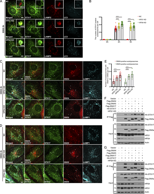 BLOC3 activation of Rab32 and Rab38 is required for STX17 retrieval from autolysosomes. (A) U2OS cells stably expressing Flag-STX17 were transfected with non-targeting siRNA (NC) or siRNA against HPS1 or HPS4. 48 h after transfection, cells were starved with EBSS for 5 h and stained with antibodies against Flag, LC3, and LAMP2. Scale bar, 5 μm. Inset scale bar, 1 μm. (B) Quantification of STX17 positive autolysosomes in A and (S4A). Data are means ± SD (n = 3, 60 cells from three independent experiments were quantified). ****P < 0.0001. Two-way ANOVA. (C) U2OS cells stably expressing GFP-STX17-TM, LAMP1-CFP, and mKATE2-SNX4 were transfected with non-targeting siRNA (NC), siRNA against HPS1 or HPS4. 48 h after transfection, cells were starved with EBSS for 2 h. Scale bar, 5 μm. (D) U2OS cells stably expressing GFP-STX17-TM, LAMP1-CFP, and mKATE2-SNX5 were transfected with non-targeting siRNA (NC), siRNA against HPS1 or HPS4. 48 h after transfection, cells were starved with EBSS for 2 h. Scale bar, 5 μm. (E) Quantification of SNX4 or SNX5 localization to autolysosomes in C and D. Data are means ± SD for (n = 3, 60 cells from three independent experiments were quantified). ****P < 0.0001. One-way ANOVA. (F and G) HEK293T cells were transfected with non-targeting siRNA (NC) or siRNA against HPS1 or HPS4. 24 h after transfection, cells were transfected with HA-STX17 with vector, Flag-SNX4, Flag-SNX5, or Flag-SNX17. Another 24 h after transfection, cells were lysed and immunoprecipitated with anti-Flag antibody. The precipitates were blotted with the indicated antibodies. Source data are available for this figure: SourceData F2. Refer to the image caption for details.