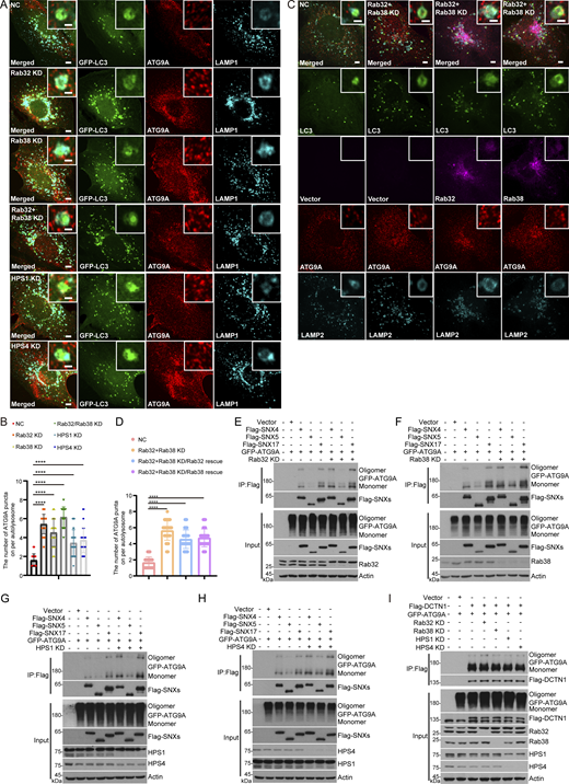 Rab32 and Rab38 are required for the retrieval of ATG9A from autolysosomes. (A) U2OS cells stably expressing GFP-LC3 were transfected with non-targeting siRNA (NC) or siRNA against Rab32, Rab38, Rab32 and Rab38, HPS1, or HPS4. 48 h after transfection, cells were starved with EBSS for 2 h and stained with antibodies against GFP, ATG9A, and LAMP1. Scale bar, 5 μm. Inset scale bar, 1 μm. (B) Quantification of ATG9A puncta on autolysosomes in (A). Data are means ± SD (n = 3, 60 cells from three independent experiments were quantified). ****P < 0.0001. One-way ANOVA. (C) U2OS cells stably expressing GFP-LC3 with vector or siRNA resistant mKO-Rab32/Rab38 were transfected with non-targeting siRNA (NC), siRNA against Rab32 and Rab38. 48 h after transfection, cells were starved with EBSS for 2 h and stained with antibodies against ATG9A and LAMP2. Scale bar, 5 μm. Inset scale bar, 1 μm. (D) Quantification of ATG9A puncta on autolysosomes in C. Data are means ± SD (n = 3, 60 cells from three independent experiments were quantified). ****P < 0.0001. One-way ANOVA. (E–H) HEK293T cells were transfected with non-targeting siRNA (NC) or siRNA against Rab32, Rab38, HPS1, or HPS4. 24 h after transfection, cells were transfected with the indicated plasmids. Another 24 h after transfection, cells were lysed and immunoprecipitated with anti-Flag antibody. The precipitates were analyzed with the indicated antibodies. (I) HEK293T cells were transfected with non-targeting siRNA (NC) or siRNA against Rab32, Rab38, HPS1, or HPS4. 24 h after transfection, cells were transfected with the indicated plasmids. Another 24 h after transfection, cells were lysed and immunoprecipitated with anti-Flag antibody. The precipitates were analyzed with the indicated antibodies. Source data are available for this figure: SourceData F6.