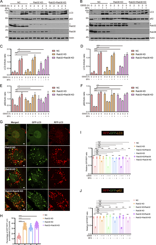 Rab32 and Rab38 positively regulate autophagic flux. (A and B) Wild-type 293T cells, as well as 293T cells with Rab32 or Rab38 knockdown, were subjected to starvation with EBSS and treated with or without 100 nM Bafilomycin A1 for 2 or 5 h. Subsequently, immunoblots were conducted using the specified antibodies. * indicates a non-specific band. (C–F) Quantification of LC3-II and p62 band intensity in A and B. The intensity of LC3-II and p62 bands were normalized to actin. Data are means ± SD of three independent experiments. *P < 0.05, **P < 0.01, ***P < 0.001, ****P < 0.0001. Two-way ANOVA. (G) U2OS cells stably expressing RFP-GFP-LC3 were transfected with non-targeting siRNA (NC) or siRNA against Rab32 or Rab38 or Rab32 and Rab38. 48 h after transfection, cells were starved with EBSS for 4 h. Scale bar, 5 μm. (H) Quantification of the ratio of GFP+RFP+-LC3/total LC3 puncta in G. Data are mean ± SD (n = 3, 60 cells from three independent experiments were quantified). ****P < 0.0001, one-way ANOVA. (I and J) Quantification of the GFP/RFP intensity ratio was performed using flow cytometry. Data are mean ± SD of three independent experiments. ns, no significance, ****P < 0.0001. Two-way ANOVA. Source data are available for this figure: SourceData F8. Refer to the image caption for details.