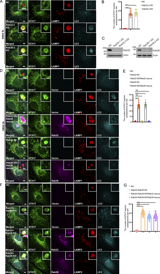 The STX17 retrieval defect caused by Rab32/Rab38 knockdown is rescued by the expression of wild-type Rab32/Rab38. (A) U2OS cells stably expressing Flag-STX17 were transfected with non-targeting siRNA (NC), siRNA against Rab32 or Rab38. 48 h after transfection, cells were starved with EBSS for 5 h and stained with antibodies against Flag, LC3, and LAMP1. Scale bar, 5 μm. Inset scale bar, 1 μm. (B) Quantification of STX17 positive autolysosomes in A. Data are means ± SD (n = 3, 60 cells from three independent experiments were quantified). ****P < 0.0001. One-way ANOVA. (C) U2OS cells stably expressing Flag-STX17 were transfected with the indicated siRNAs. 48 h after transfection, cells were subjected to immunoblot with antibodies against Rab32, Rab38, and Actin. (D) U2OS cells stably expressing Flag-STX17 with vector or siRNA resistant mKO-Rab32/Rab38 were transfected with non-targeting siRNA (NC), siRNA against Rab32 or Rab38. 48 h after transfection, cells were starved with EBSS for 5 h and stained with antibodies against Flag, LC3, and LAMP1. Scale bar, 5 μm. Inset scale bar, 1 μm. (E) Quantification of STX17 positive autolysosomes in D. Data are means ± SD (n = 3, 60 cells from three independent experiments were quantified). ns, no significance. ****P < 0.0001. One-way ANOVA. (F) U2OS cells stably expressing Flag-STX17 with vector or siRNA resistant mKO-Rab32/Rab38 were transfected with non-targeting siRNA (NC), siRNA against Rab32 and Rab38. 48 h after transfection, cells were starved with EBSS for 5 h and stained with antibodies against Flag, LC3, and LAMP2. Scale bar, 5 μm. Inset scale bar, 1 μm. (G) Quantification of STX17 positive autolysosomes in F. Data are means ± SD (n = 3, 60 cells from three independent experiments were quantified). ****P < 0.0001. One-way ANOVA. Source data are available for this figure: SourceData FS3.