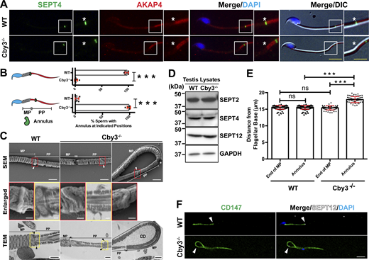 The annulus is displaced into the principal piece in Cby3−/−sperm. (A) Cauda epididymal sperm were immunostained for SEPT4 and AKAP4. Asterisks indicate the MP/PP junction. (B) Quantification of sperm with the indicated annulus positions (n = 8 fields of view with ≥ 25 annuli per field). (C) SEM and TEM studies of cauda epididymal sperm. Enlarged images of the boxed regions are shown in the middle panels. Arrowheads denote the annulus. Asterisks indicate the MP/PP junction. MP, midpiece; PP, principal piece; CD, cytoplasmic droplet. (D) Testis lysates prepared from adult mice were processed for Western blotting using antibodies against SEPT2, 4, and 12. GAPDH was used as a loading control. (E) Quantification of the distance from the base of the flagellum to the distal end of the MP or the annulus (n = 8 fields of view with ≥60 sperm per field). Mitochondria and the annulus were detected by Biotracker and SEPT4 antibody, respectively. (F) Cauda epididymal sperm were immunostained for CD147 and SEPT12 (arrowheads). Nuclei were detected with DAPI. Scale bars for A, 10 and 5 µm (enlarged images); C, 1 µm and 200 nm (enlarged images); F, 10 μm. Means ± SD are shown. Student’s t test: ***P < 0.001, not significant (ns). Source data are available for this figure: SourceData F3. Refer to the image caption for details.