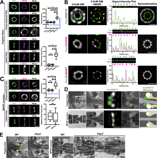 Ultrastructure expansion microscopy reveals a ring-like organization of Cby3- and ciBAR1-asociated structures at the annulus. (A and C) Adult testis sections were expanded via U-ExM and immunostained for Cby3, ciBAR1, and SEPT4, and fluorescence signals at the flagellar base or MP/PP junction were imaged using SIM. The diameter and relative position of ring structures were quantified (n ≥ 32 measurements per each). See also Tables S5 and S6. (B) Adult testis sections were expanded via U-ExM and immunostained for Cby3, ciBAR1, and SEPT4. Fluorescence signals at the flagellar base were imaged using SIM and processed by MSSR. Radial intensity profile plots and ninefold symmetrized images were generated. (D) ExM-SIM images for lateral views of Cby3 and SEPT4 in A and C were overlayed with TEM images. (E) WT and Cby3−/− adult testes were subjected to TEM. The annuli at the flagellar base and the MP/PP junction are indicated by the arrowheads. Yellow arrows point to the membrane invagination of the flagellar pocket. Yellow asterisks indicate the MP/PP junction. White asterisks denote the accumulation of submembranous electron-dense materials in the PP. Blue dashed lines represent an experimentally measured axonemal diameter (See Fig. S5 B). Box and whisker plots represent median and minimum/maximum values. Student’s t test: ***P < 0.001, not significant (ns). Scale bars for A–C, 272 nm; D, 1 µm and 272 nm (enlarged TEM and IF images); E, 250 nm.