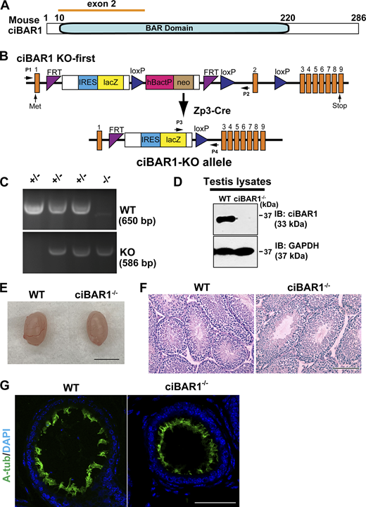Generation and initial characterization of ciBAR1−/−mice. (A) Schematic of ciBAR1 protein structure. (B) Generation of ciBAR1−/− mice. (C) PCR genotyping of ciBAR1 mice. The locations of genotyping primers for WT (P1 and P2, 650 bp) and KO (P3 and P4, 586 bp) alleles are indicated by arrows in B. (D) Testis lysates prepared from adult mice were processed for Western blotting using antibodies against ciBAR1 and loading control GAPDH. (E) Representative adult testis images. (F) Representative images of PAS staining of adult testis sections. (G) Paraffin sections of male efferent ducts were immunostained for A-tub. Nuclei were detected with DAPI. Scale bars for E, 5 mm; F, 100 µm; and G, 50 µm. Source data are available for this figure: SourceData FS4.