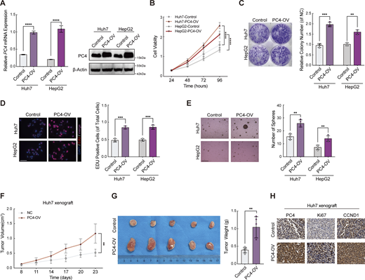 PC4-OV promotes liver cancer cell growth in vitro and in vivo. Relative to Fig. 5. (A) Western blot and qPCR showing PC4 expression in Huh7 and HepG2 cells stably overexpressing control or PC4. Data are generated from n = 3 biological replicates. (B) Cell viability analysis by CCK8 assay in Huh7 cells and HepG2 cells with control or PC4 stable overexpression. Data are generated from n = 3 biological replicates. (C) Colony assay in Huh7 and HepG2 cells with control or PC4 stable overexpression. Data are generated from n = 3 biological replicates. (D) EdU immunofluorescent staining performed in cells stably expressing control or PC4-OV. Scale bar = 75 μm. Data are generated from n = 3 biological replicates. (E) Soft agar assay in cells with control or PC4 stable overexpression. Scale bar = 300 μm. Data are generated from n = 4 biological replicates. (F) Tumor volume in the nude mice subcutaneously injected with Huh7 cell stably expressing control or PC4. Data are generated from n = 5 biological replicates. (G) Photographs of dissected tumors and tumor weight in the nude mice subcutaneously injected with Huh7 cell stably expressing control or PC4. (H) Representative images of Ki67 (top) and PC4 (bottom) immunostaining in the nude mice subcutaneously injected with Huh7 cell stably expressing control or PC4. Scale bar = 75 μm. Data are generated from n = 5 biological replicates. All quantifications were shown as means ± SD (one-way ANOVA test); error bars represent SD. **P < 0.01, ***P < 0.001, ****P < 0.0001. Source data are available for this figure: SourceData FS5. Refer to the image caption for details.