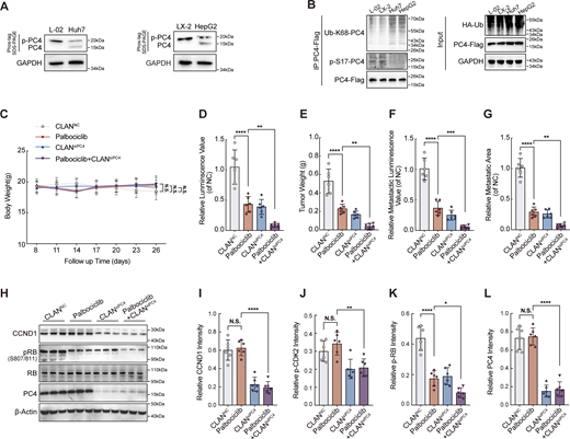 PC4 exhibits distinct modifications in HCC, and PC4 loss sensitizes HCC cells to CDK4/6 inhibitors. Related to Fig. 7. (A) Western blot showing the phosphorylated and unphosphorylated PC4 expressions in four liver cells (Huh7, HepG2, L-02, and LX-2). (B) Western blot showing ubiquitination and phosphorylation levels of endogenous PC4 in four liver cells (Huh7, HepG2, L-02, and LX-2). (C) Body weight from CLANNC(n = 6), Palbociclib (n = 6), CLANsiPC4(n = 6), or Palbociclib+CLANsiPC4 (n = 6) -treated Huh7-Luc xenografts mice at each time point in Fig. 7 F. (D) Luminescence value from Huh7-Luc xenografts mice treated in Fig. 7 G. Data were generated from n = 6 in each group. (E) Quantification of tumor weight from Huh7-Luc xenografts mice treated in Fig. 7 F. Data were generated from n = 6 in each group. (F) Quantification of metastatic luminescence value in Fig. 7 L. Data are generated from n = 6 in each group. (G) Quantification of metastatic area in Fig. 7 L. Data are generated from n = 6 in each group. (H) Western blot showing the indicated protein expressions in CLANNC (n = 3), Palbociclib (n = 3), CLANsiPC4 (n = 3), and Palbociclib+CLANsiPC4 (n = 3) -treated Huh7-Luc xenografts. (I) Quantifications of CCND1 intensity in immunostaining from Huh7-Luc xenografts mice treated in Fig. 7 F. (J) Quantifications of p-CDK2 intensity in immunostaining from Huh7-Luc xenografts mice treated in Fig. 7 F. (K) Quantifications of p-RB intensity in immunostaining from Huh7-Luc xenografts mice treated in Fig. 7 F. (L) Quantifications of PC4 intensity in immunostaining from Huh7-Luc xenografts mice treated in Fig. 7 F. All quantifications were shown as means ± SD (one-way ANOVA test); error bars represent SD. *P < 0.05, **P < 0.01, ***P < 0.001, ****P < 0.0001. A, B, H, and J–L are independent experiments. Source data are available for this figure: SourceData FS7.
