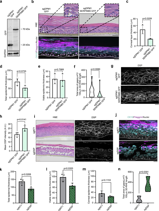 SERPINB5 rescues defects in epidermal differentiation in response to DPM1 loss. (a) Western blot showing SERPINB5-GFP expression in primary human keratinocytes that lack DPM1. GFP served as control. GAPDH used as internal loading control. (b) H&E staining of 3D-RHE from sgDPM1 expressing GFP control or SERPINB5-GFP 12 days after airlift. Immunostainings of CK10 and filaggrin were used as differentiation markers. Scale bar: 50 µm distance on H&E images and 10 µm on immunostaining images. Insets zoomed 2× of original image. White dashed line indicates insert membrane. Panel shows representatives from three biological replicates. (c–e) Quantification of corneal layer thickness, total epidermal thickness, and viable (non-corneal) epidermal layer thickness from three independent biological replicates. Student’s t test, unpaired. (f) Violin plot showing quantification of intercellular spaces within the epidermis in sgDPM1 GFP and sgDPM1 SERPINB5 GFP 3D-RHE. The area for defining intercellular spaces was set to be >50 µm2 to exclude shrinking artifacts. A minimum of 15 individual fields of view were used for analysis from three independent biological replicates. Unpaired Student’s t test. (g and h) Immunostaining and analysis of DSP intensity of sgDPM1 GFP and sgDPM1 SERPINB5-GFP 3D-RHEs. Panel shows representative of four biological replicates. Scale bar: 10 µm distance. Unpaired Student’s t test used to determine statistical significance (N = 4). (i and j) H&E staining of sgDSP 3D-RHEs 12 days after airlift. DSP staining shows depletion of DSP in sgDSP 3D-RHE. Immunostainings for CK10 and filaggrin used as differentiation markers. Scale bar: 50 µm distance on H&E images and 10 µm on immunostaining images. White dashed line indicates insert membrane. Panel shows representatives from three biological replicates. (k–m) Quantification of total epidermal thickness, viable (non-corneal) epidermal layer thickness, and corneal layer thickness from three independent biological replicates. Student’s t test, unpaired. (n) Violin plot showing quantification of intercellular spaces within the epidermis in sgNT1 and sgDSP 3D-RHE. A minimum of 15 individual fields of view were used for analysis from three independent biological replicates. Unpaired Student’s t test. Source data are available for this figure: SourceData F5. Refer to the image caption for details.