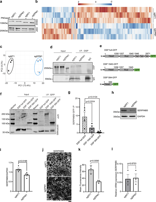SERPINB5 binds to DSP preferably at the rod and tail domains. (a) Western blot showing migration of DSG2 and DSP upon treatment with PNGaseF in sgNT1 versus sgDPM1 HaCaT keratinocytes. (b) Heat map showing differential protein expression profiles in sgNT1 and sgDPM1 HaCaT keratinocytes from three biological replicates. Color scale represents log2 fold change of intensity values. (c) Principal component (PC) analysis of the samples used in b. (d) Immunoprecipitation (I.P.) assay showing DSP pulldown in sgNT1 and sgDPM1 cells. IgG used as negative control. Panel shows representative of two biological replicates. (e) Schematic depicting the different truncated DSP constructs fused with GFP at the C-terminus. (f and g) Coimmunoprecipitation assay showing SERPINB5 binding to respective DSP truncated-GFP mutants expressed in HaCaT sgDSP cells. Quantification of SERPINB5 in I.P. samples normalized to the respective amounts of GFP immunoprecipitated. One-way ANOVA, Dunnett’s multiple comparison test, from three independent biological replicates. (h and i) Western blot and corresponding quantification of SERPINB5 expression in sgDPM1 HaCaT keratinocytes. N = 4, unpaired Student’s t test. (j and k) Images and quantification of SERPINB5 immunostainings in sgNT1 and sgDPM1 HaCaT keratinocytes. Scale bar: 10 µm distance. Panel represents three biological replicates. Unpaired Student’s t test (N = 3). (l) qPCR analysis of relative expression of SERPINB5 transcripts in sgNT1 and sgDPM1 cells. GAPDH used as housekeeping control and SERPINB5 transcript expression normalized to GAPDH. Each dot represents individual biological replicates, Unpaired Student’s t test. Source data are available for this figure: SourceData FS2.