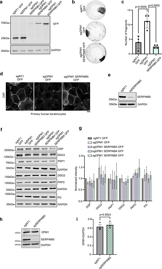 SERPINB5 rescues defects induced by DPM1 loss in primary keratinocytes. (a) Western blot showing expression of the respective SERPIN-GFP constructs in sgDPM1 HaCaT keratinocytes. GFP used as control. GAPDH used as loading control. Panel shows representative of three biological replicates. (b and c) Dispase-based dissociation assays to semiquantitatively assess cell–cell adhesion in primary human keratinocytes overexpressing SERPINB5-GFP in sgDPM1 background (N = 4). One-way ANOVA, Dunnett’s multiple comparison test used for statistics. (d) Images of DSP immunostainings in sgNT1-GFP, sgDPM1-GFP, and sgDPM1-SERPINB5 GFP in primary human keratinocytes. Scale bar: 10 µm distance. Panel represents three biological replicates. (e) Western blot showing SERPINB5 levels in sgNT1 and sgSERPINB5 HaCaT keratinocytes. Image represents three biological replicates. (f and g) Western blot images and quantifications of desmosomal proteins from sgNT1 and sgDPM1 HaCaT keratinocytes expressing the indicated SERPIN-GFP constructs. GAPDH used as internal loading control (N = 3). (h and i) Western blot images and quantifications of DPM1 from sgNT1 and sgSERPINB5 HaCaT keratinocytes. GAPDH used as internal loading control (N = 3). Unpaired Student’s t test. Source data are available for this figure: SourceData FS3.