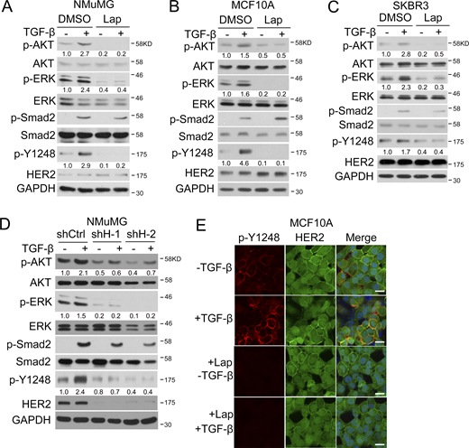 TGF-β-induced activation of AKT and ERK requires HER2 activity. (A–C) NMuMG, MCF10A, and SKBR3 cells were treated with 2 μM (A and B) or 0.1 μM (C) Lapatinib (Lap) for 2 h, and 100 pM TGF-β1 was added in the last 1 h. Cells were then harvested for immunoblotting. (D) Control and HER2 knockdown NMuMG cells were treated with 100 pM TGF-β1 for 1 h and then harvested for immunoblotting. (E) MCF10A cells were treated with 2 μM Lapatinib for 2 h and 100 pM TGF-β1 was added in the last 1 h, followed by anti-HER2 Y1248 immunofluorescence (red) and anti-HER2 immunofluorescence (green). The nuclei were counterstained by DAPI (blue). Bar, 20 μm. Source data are available for this figure: SourceData F1. Refer to the image caption for details.