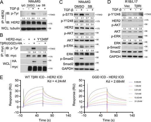 TGF-β-enhanced HER2 activity depends on TβRI kinase activity. (A) NMuMG cells were treated with 2 μM Lapatinib or 5 μM SB431542 (SB) for 2 h, and 100 pM TGF-β1 was added in the last 1 h before being harvested for anti-HER2 pulldown and then for anti-phospho-tyrosine immunoblotting. (B) HEK293T cells were transfected with indicated plasmids before being harvested for anti-Myc pulldown and then for anti-phospho-Tyrosine immunoblotting. (C) NMuMG cells were treated with 5 μM SB431542 for 2 h, and 100 pM TGF-β1 was added in the last 1 h. Cells were then harvested for immunoblotting. (D) R1B/L17 cells overexpressed with empty vector or TβRI were treated with 100 pM TGF-β1 for 1 h before being harvested for immunoblotting. (E) SPR analysis of TβRI WT ICD—HER2 ICD and GGD ICD—HER2 ICD interactions. HER2 ICD protein was immobilized on Series S sensor chips CM5, and the binding experiments were carried out using a Biacore S200. The estimated Kd values were derived by fitting the association and dissociation signals with a 1:1 (Langmuir) model using the Biacore S200 Evaluation Software. The band intensity of phosphorylated proteins was normalized to total proteins. Source data are available for this figure: SourceData F2. Refer to the image caption for details.