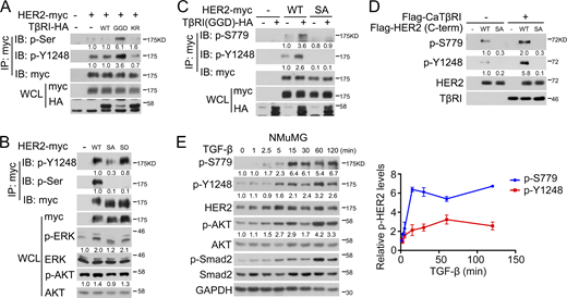 TGF-β induces HER2 phosphorylation at Ser779. (A–C) HEK293T cells were transfected with indicated plasmids before being harvested for anti-myc pulldown and then for anti-phospho-serine and anti-p-Y1248 (A and B), anti-p-S779, and anti-p-Y1248 (C) immunoblotting. (D) Flag-tagged activated intracellular domain of TβRI (caTβRI, 148 aa–503 aa) protein (200 ng) was incubated with 2 μg WT or S779A mutant HER2 protein containing intracellular domain (C-term, 712 aa–1255 aa) in an in vitro kinase assay, and the phosphorylation of HER2 at S779 and Y1248 sites were detected with anti-p-S779 and anti-p-Y1248 immunoblotting. (E) NMuMG cells were treated with 100 pM TGF-β1 for indicated times before being harvested for immunoblotting. p-HER2 (p-S779 and p-Y1248) levels were quantified. The band intensity of phosphorylated proteins was normalized to total proteins. Source data are available for this figure: SourceData F3. Refer to the image caption for details.