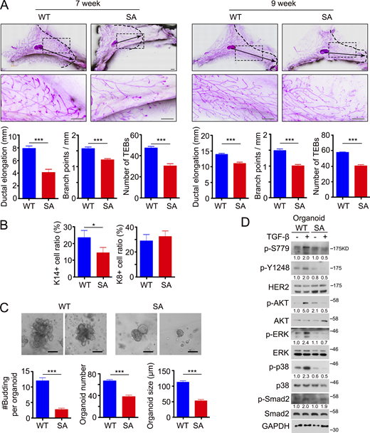 The residue S779 in HER2 is important for mammary epithelial morphogenesis. (A) Branching trees of the #4 mammary glands from control (WT: ERBB2+/+;MMTV-Cre) mice and mammary-specific HER2 S779A mutant (SA: ERBB2S780A/+;MMTV-Cre) mice at 7- and 9-wk old. Arrows indicate the extent of ductal penetration in the fat pad. The dotted black line illustrates the epithelial invasion front (n ≥ 3/genotype). Below: Quantitation of ductal elongation, branching and number of TEBs (terminal end buds) between WT and SA glands. Bar, 1 mm. (B) Representative flow cytometry plots and quantification of K14+ basal (CD24+ CD29high) and K8+ luminal (CD24+ CD29low) mammary epithelial cells in WT and SA glands, respectively. (C) Representative images of organoids at day 4 after removing FGF2. Average number of buds (#Budding) per organoid, organoid size, and organoid number per well (24-well plate) were quantified. Mammary fragments from WT and SA mice at 9-wk-old were isolated and cultured for 4 days before removing FGF2. Bar, 100 μm. (D) Immunoblotting of HER2 phosphorylation at S779 and Y1248 sites, AKT, ERK, and p38 phosphorylation in response to 1 h-TGF-β stimulation in the organoids from WT and SA glands. Statistical analyses were performed with Student’s t test (two-sided, *P < 0.05, ***P < 0.001). For the bar charts, data were plotted as mean ± SD of at least three independent experiments. The band intensity of phosphorylated proteins was normalized to total proteins. Source data are available for this figure: SourceData F4. Refer to the image caption for details.
