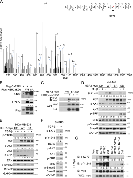 TGF-β-enhanced HER2 S779 phosphorylation is important for the activation of HER2 AKT and ERK. (A) HEK293T cells transfected with HER2-myc and GGD-HA were harvested for anti-myc immunoprecipitation. After digestion, the HER2 peptides were analyzed with LC-MS/MS to identify the phosphorylation sites. The residue S779 was marked with a red asterisk on the top-right corner. (B) Flag-tagged intracellular domain of activated TβRI protein (caTβRI, 148 aa–503 aa) (200 ng) was incubated with 2 μg WT or S779A mutant HER2 protein containing the kinase domain (KD, 712 aa–990 aa) in an in vitro kinase assay, and the total serine phosphorylation of HER2 (marked by black asterisk) and HER2 phosphorylation at Y877 site were detected with immunoblotting. (C) HEK293T cells were transfected with indicated plasmids before being harvested for anti-HA pulldown and then for anti-myc immunoblotting. (D) HER2-knockdown NMuMG cells expressed with GFP, WT HER2, S779A mutant (SA), or S779D mutant (SD) were treated with 100 pM TGF-β for 1 h before harvesting for immunoblotting. (E) MDA-MB-231 cells overexpressed with GFP, WT HER2, or S779A mutant (SA) were treated with 100 pM TGF-β1 for 1 h before harvested for immunoblotting. (F) SKBR3 cells were treated with 100 pM TGF-β1 for 1 h before being harvested for immunoblotting. (G) HEK293T cells were transfected with indicated plasmids before being harvested for anti-myc pulldown and then for anti-p-S779 and anti-p-Y1248 immunoblotting. The band intensity of phosphorylated proteins was normalized to pull-down HER2 proteins. Source data are available for this figure: SourceData FS2.