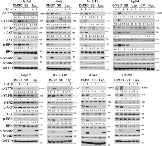 Enhancement of HER2 activity by TGF-β is observed in multiple epithelial cells and cancer cells. HaCaT, HeLa, NIH 3T3, EpH4, HepG2, KYSE410, A549, and H1299 cells were treated with 5 μM SB-431542, 2 μM Lapatinib, 10 μM CP-724714, or 8 μM Nystatin for 2 h, and 100 pM TGF-β1 was added in the last 1 h before harvested for immunoblotting. The band intensity of phosphorylated proteins was normalized to total proteins. Source data are available for this figure: SourceData FS3. Refer to the image caption for details.