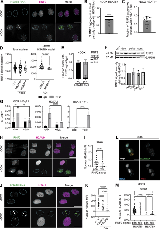 RNF2 is enriched at HSATII genomic regions and RNF2 protein aggregation correlates with loss of nuclear H2AUb signal in DUX4-expressing cells. (A) Combined RNA fluorescence in situ hybridization (RNA-FISH) and immunofluorescence of HSATII RNA (green) and RNF2 (magenta) signal in −dox or +dox (4 h pulse and fixed/analyzed 20 h after induction) iDUX4 cells, (scale bar = 20 μm). Images are representative of four independent experiments conducted on separate days. (B) Percentage of individual RNF2 foci that have at least partial signal overlap with HSATII RNA foci per nucleus in +dox iDUX4 cells. N = 50 nuclei. (C) Fraction of RNF2 nuclear aggregates present within HSATII RNA foci in +dox iDUX4 cells. Fraction calculated represents the total proportion within each individual nuclei for a representative experiment and N ≥ 100 nuclei. (D) RNF2 signal intensity measured within nuclei in −dox, +dox HSATII−, or HSATII+ nuclei compared with RNF2 signal intensity measured within HSATII RNA foci or randomly drawn ROI within the nucleoplasm in +dox HSATII+ nuclei. Each dot represents either individual nuclei or individual foci, respectively. Nuclei are indicated for representative experiment and N ≥ 100 nuclei per condition or N ≥ 40 ROI. (E) Fraction nuclei with RNF2 signal type: foci versus pan-nuclear (pan) staining patterns within +dox cells either with HSATII RNA (pos) or without HSAT RNA (neg). Fraction calculated represents fields taken from each independent experiment and N ≥ 100 nuclei. (F) Quantification of total RNF2 protein levels in +eto, −dox, pulse, or continuous +dox conditions. Blot shows two biological replicates for each condition. (G) Chromatin immunoprecipitation (ChIP) of RNF2 or IgG isotype control in −dox or +dox (4 h pulse and fixed/analyzed 20 h after induction) iDUX4 cells. Quantitative PCR (qPCR) was performed on isolated DNA from RNF2- or IgG-bound chromatin fractions. Primers targeting a control gene desert region (GDR) h16q21 (Maston et al., 2012), canonical PcG-target gene HOXA1, or HSATII 1q12 were used. N = 3 per IP per condition. (H) Representative immunofluorescence images of RNF2 signal (green) and H2AUb signal (magenta) in −dox or +dox (4 h pulse and fixed/analyzed 20 h after induction) iDUX4 cells, (scale bar = 20 μm). Images are representative of two independent experiments conducted on separate days. (I) Nuclear H2AUb MFI was calculated for nuclei that contained RNF2 pan-nuclear signal (pan) or RNF2 aggregates (foci). Nuclei are indicated for representative experiment and N ≥ 50 nuclei per condition. (J) Combined RNA-FISH and immunofluorescence of HSATII RNA (green) and H2AUb (magenta) signal in −dox or +dox (4-h pulse and fixed/analyzed 20-h after induction) iDUX4 cells, (scale bar = 20 μm). Images are representative of two independent experiments conducted on separate days. (K) Nuclear H2AUb MFI was calculated in −dox cells or +dox cells in nuclei that contained no HSATII RNA (HSATII−) or HSATII RNA foci (HSATII+). Nuclei are indicated for representative experiment and N ≥ 50 nuclei per condition. (L) Combined RNA-FISH and immunofluorescence of HSATII RNA (green), H2AUb (cyan), and RNF2 (red) signal in +dox (4 h pulse and fixed/analyzed 20 h after induction) iDUX4 cells, (scale bar = 20 μm). Images are representative of two independent experiments conducted on separate days. (M) Nuclear H2AUb MFI was calculated in +dox cells in nuclei that contained no HSATII RNA (HSATII−) or HSATII RNA foci (HSATII+) with RNF2 signal type. Nuclei are indicated for representative experiment and N ≥ 50 nuclei per condition unless stated otherwise. (C–G, I, K, and M) Data represent means ± SD. Statistical differences between groups were analyzed employing either nonparametric Mann–Whitney test in the absence of normal distribution, two-tailed paired t test, or were assessed with one-way ANOVA Tukey’s multiple comparisons test or two-way ANOVA Sidak’s multiple comparison test between each group and a control. Source data are available for this figure: SourceData F1.