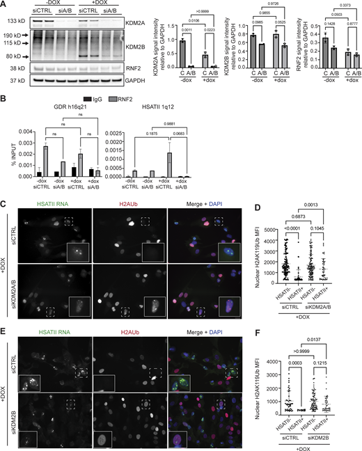 KDM2 proteins recruit RNF2 to HSATII genomic loci impacting global H2AUb signal. (A) siRNA depletion of either KDM2A and KDM2B (siA/B) or control (siCTRL) sequences in −dox or +dox (4 h pulse and fixed/analyzed 20 h after induction) iDUX4 cells. Western blot was performed on whole cell lysate and probed for KDM2A, KDM2B, and RNF2. GAPDH was used as the loading control. N = 3 per condition, blot shows two replicates. (B) Paired cells from A were used for ChIP-qPCR of RNF2 or IgG isotype control in −dox or +dox with (siA/B) or without (siCTRL) KDM2A/B depletion in iDUX4 cells. Primers targeting control GDR h16q21 (Maston et al., 2012) or HSATII 1q12 were used. N = 3 per IP per condition. (C) Combined RNA-FISH and immunofluorescence of HSATII RNA (green) and H2AUb (red) signal in +dox (4 h pulse and fixed/analyzed 20 h after induction) iDUX4 cells with (siKDM2A/B) or without (siCTRL) KDM2A/B depletion, (scale bar = 10 μm). Images are representative of two independent experiments conducted on separate days. (D) Quantification of nuclear H2AUb MFI was calculated in +dox cells with (siKDM2A/B) or without (siCTRL) KDM2A/B depletion in nuclei that contained no HSATII RNA (HSATII−) or HSATII RNA foci (HSATII+). Nuclei are indicated for each independent experiment and N ≥ 100 nuclei per condition. (E) Combined RNA-FISH and immunofluorescence of HSATII RNA (green) and H2AUb (red) signal in +dox (4-h pulse and fixed/analyzed 20 h after induction) iDUX4 cells with (siKDM2B) or without (siCTRL) KDM2B depletion, (scale bar = 10 μm). Images are representative of two independent experiments conducted on separate days. (F) Quantification of nuclear H2AUb MFI was calculated in +dox cells with (siKDM2B) or without (siCTRL) KDM2B depletion in nuclei that contained no HSATII RNA (HSATII−) or HSATII RNA foci (HSATII+). Nuclei are indicated for each independent experiment and N ≥ 100 nuclei per condition. (A, B, D, and F) Data represent means ± SD. Statistical differences between groups were analyzed with one-way ANOVA Tukey’s multiple comparison test, Kruskal–Wallis test, or two-way ANOVA Sidak’s multiple comparison test between each group and a control. Source data are available for this figure: SourceData F4.