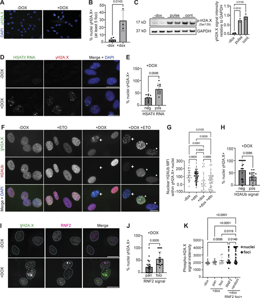Nuclei with PRC1 aggregation, HSATII RNA accumulation, and H2AUb depletion have increased incidence of DNA damage. (A) Representative immunofluorescence images of γH2A.X signal (green) in uninduced (−dox; no DUX4 expression) or induced with 2 μg/ml doxycycline for 24-h (+dox; DUX4-expressing) iDUX4 cells (scale bar = 20 μm). Images are representative of four independent experiments conducted on separate days. (B) Percent γH2A.X positive (containing at least 5 γH2A.X foci) nuclei are indicated for three independent experiments. N ≥ 100 random nuclei per condition within each experiment. (C) Western blot was performed on whole-cell lysate and probed for phosphorylated H2A.X at Serine 139. GAPDH was used as the loading control. iDUX4 cells were either uninduced (−dox), briefly induced with 2 μg/ml doxycycline for 4-h (pulse) and harvested 20 h after induction or induced with 2 μg/ml doxycycline for 24 h (continuous, “cont.”). The blot shows two biological replicates. (D) Combined RNA-FISH and immunofluorescence of γH2A.X (red) and HSATII RNA (green) in −dox or +dox (4-h pulse and fixed/analyzed 20 h after induction) iDUX4 cells (scale bar = 20 μm). Images are representative of two independent experiments conducted on separate days. N ≥ 100 nuclei imaged. (E) Percentage of cells with HSATII RNA accumulation (pos) or no HSATII RNA (neg) that contain γH2A.X foci within +dox only condition. Dots represent the mean number of nuclei per field. (F) Representative immunofluorescence images of γH2A.X signal (green) and H2AK119Ub (H2AUb) signal (red) in iDUX4 cells. Cells were either uninduced (−dox), briefly induced with 10 μM etoposide for 30 min and immediately harvested (+eto), briefly induced with 2 μg/ml doxycycline for 4 h (pulse) and harvested 20 h after induction (+dox), or pulsed and treated with etoposide 30 min before harvest (+dox +eto) (scale bar = 10 μm). White arrows indicate nuclei that contain γH2A.X signal but low/negative H2AUb signal. Asterisks indicate nuclei that contain γH2A.X and H2AUb signal. Images are representative from two independent experiments conducted on separate days. (G) Nuclear H2AUb mean fluorescence intensity (MFI) was calculated for all γH2A.X positive nuclei. Nuclei are indicated for each independent experiment and N = 50–100 random nuclei per condition for the representative experiment. (H) Percentage of cells with no H2AUb signal (neg) or cells with H2AUb signal (pos) that contain γH2A.X foci within +dox only condition. Dots represent mean number of nuclei per field. (I) Representative immunofluorescence images of γH2A.X signal (green) and RNF2 signal (magenta) in −dox, or +dox (4 h pulse and fixed/analyzed 20 h after induction) iDUX4 cells, (scale bar = 20 μm). Images are representative of two independent experiments conducted on separate days. (J) Percentage of cells with RNF2 signal type (pan versus foci) that contain γH2A.X foci within +dox only condition. Dots represent the mean number of nuclei per field. (K) Phospho-H2A.X signal intensity measured within nuclei in −dox, +dox cells with RNF2 pan-nuclear signal (pan) or RNF2 foci signal, compared to γH2A.X signal intensity measured within RNF2 foci or randomly drawn ROI within the nucleoplasm in +dox RNF2 foci+ nuclei. Each dot represents either individual nuclei or individual foci, respectively. Nuclei are indicated for representative experiment and N = 10–50 nuclei per condition or N ≥ 40 ROI. (B, C, E, G, H, J, and K) Data represent means ± SD. Statistical differences between groups were analyzed employing either two-tailed paired t test or were assessed with one-way ANOVA Tukey’s multiple comparison test between each group and a control. Source data are available for this figure: SourceData F5. Refer to the image caption for details.